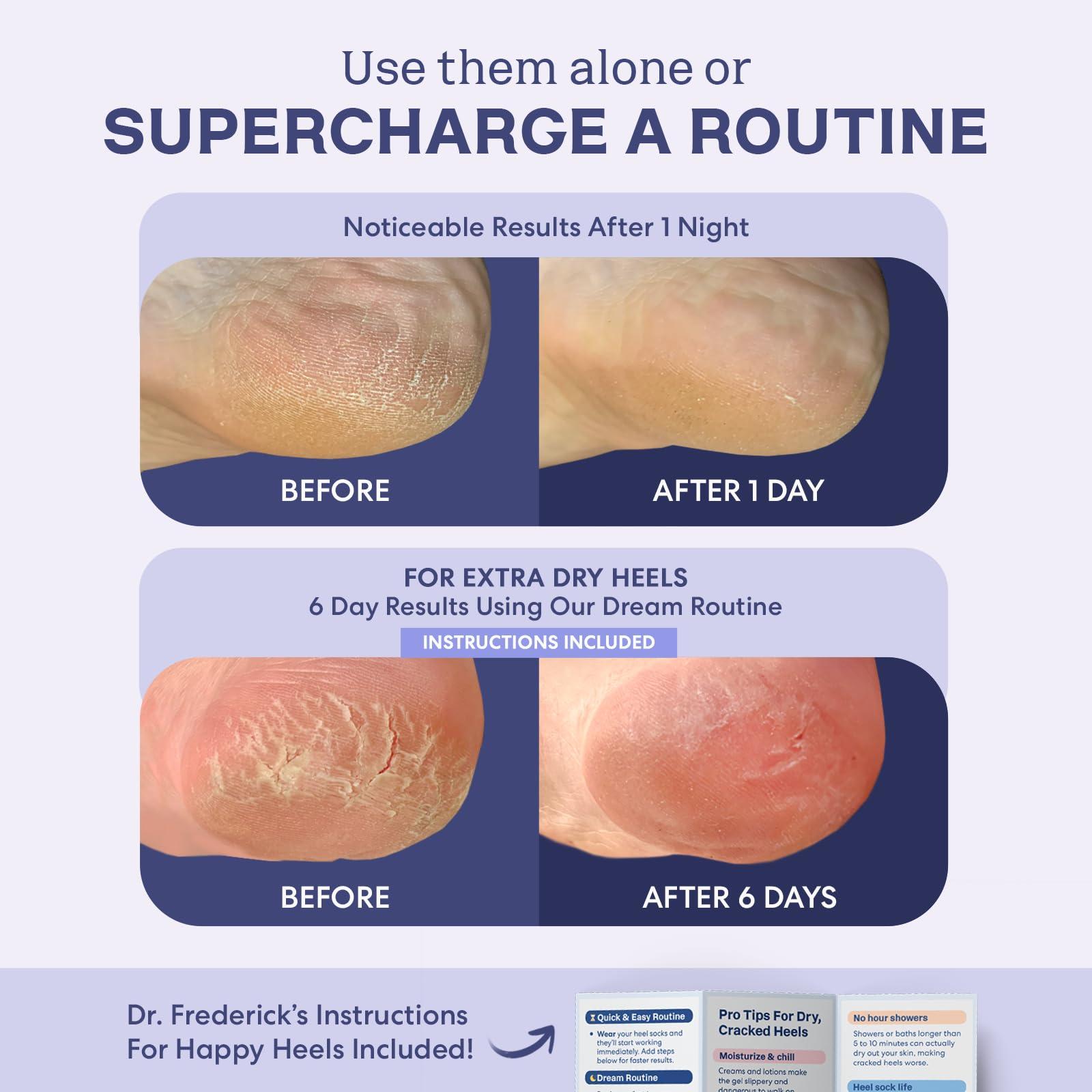 Dr. Frederick's Original Dr. Frederick's Original Moisturizing Fuzzy Heel Socks - 2 Pairs - Cozy Gel-Lined Sleep Socks for Women & Men - Soothes Dry, Cracked Feet - Heel Repair - Lilac Leisure