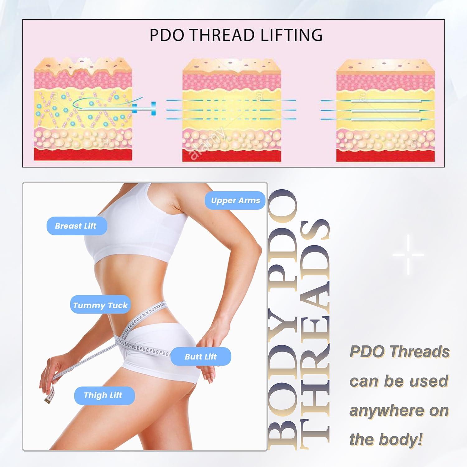 Newliky Pdo Threads for Face Lift Mono Screw Type (29G50MM) Smoothing Wrinkles PDO Thread Lift for Whole Body with Sharp Tip 20pcs