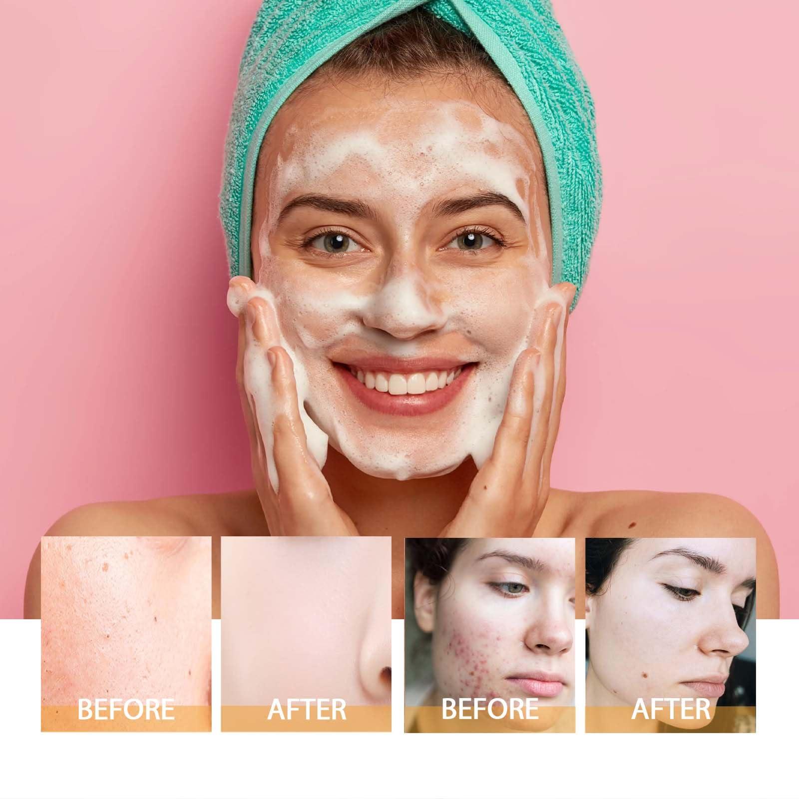 HOYGI HOYGI Turmeric Face Wash, Turmeric Facial Cleanser, Turmeric Foaming Cleanser for All Skin, 3.38 Fl Oz/pcs