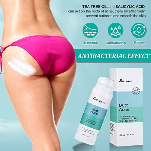 SIRUIMAO SIRUIMAO Butt Acne Clearing Treatment (3.5OZ), Bum Acne Treatment for Clearing Acne, Pimples, Blackheads, Zits and Razor Bumps for the Buttocks and Thigh Area (2 bottles)