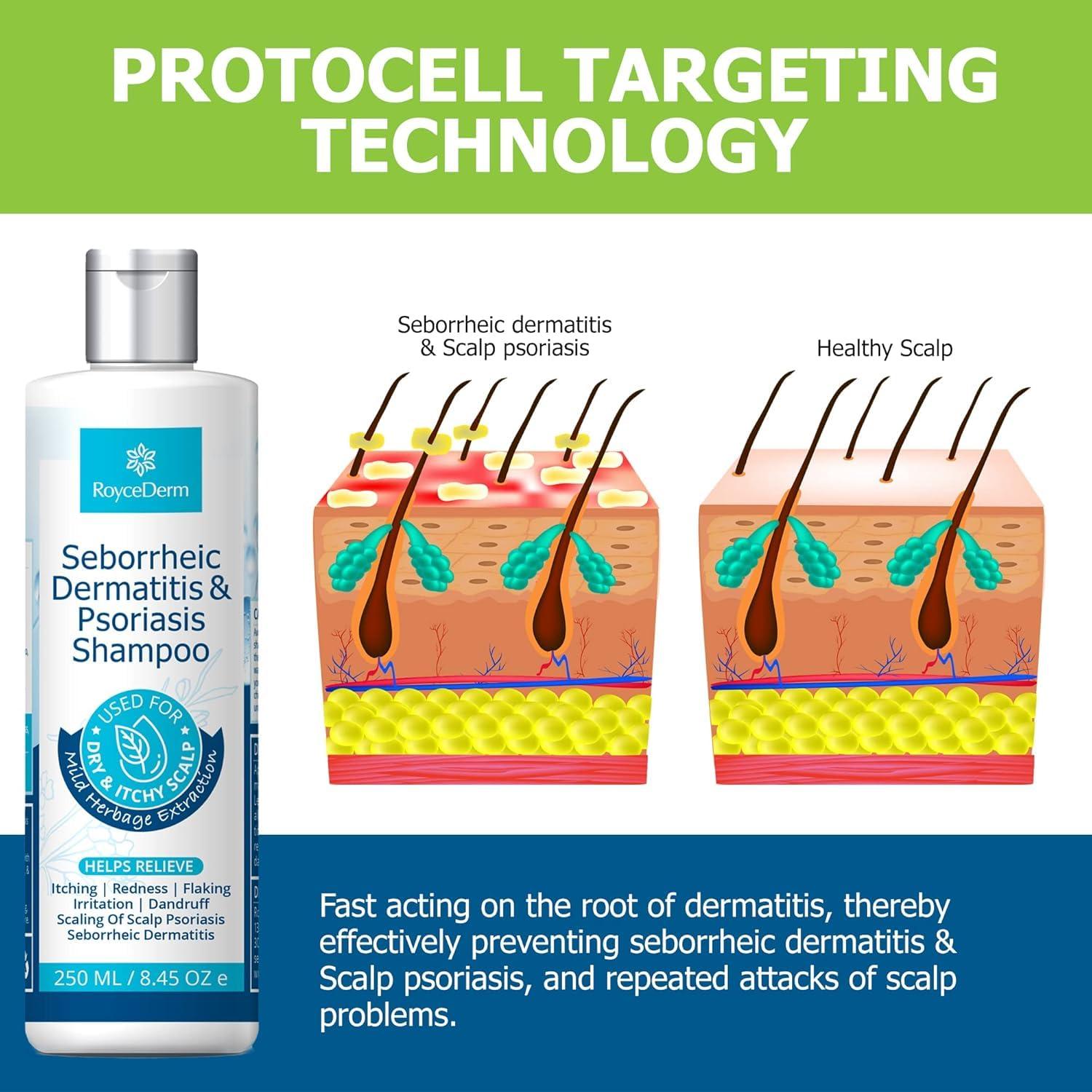 Roycederm Roycederm Psoriasis Shampoo, Seborrheic Dermatitis Shampoo, Folliculitis Shampoo, Dandruff Shampoo, Scalp Psoriasis & Seborrheic Dermatitis Treatment, Dry Itchy Scalp Treatment