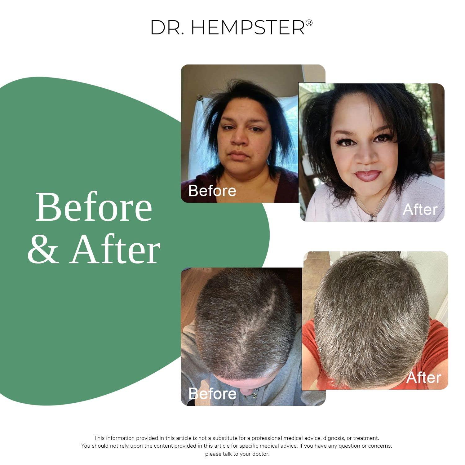 DR. HEMPSTER Biotin Hair Loss & Thinning Treatment for Men & Women - Hair Growth Shampoo for Regrowth