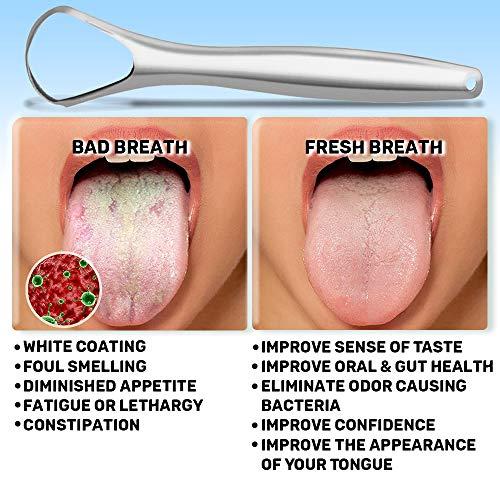 mastermedi MasterMedi Tongue Scraper with Case (Spoon Shape, 2 Pack), Medical Grade Stainless Steel Tongue Scrubber for Bad Breath Treatment, Easy to Use Tongue Scraper for Adults, Tongue Cleaner for Oral Care