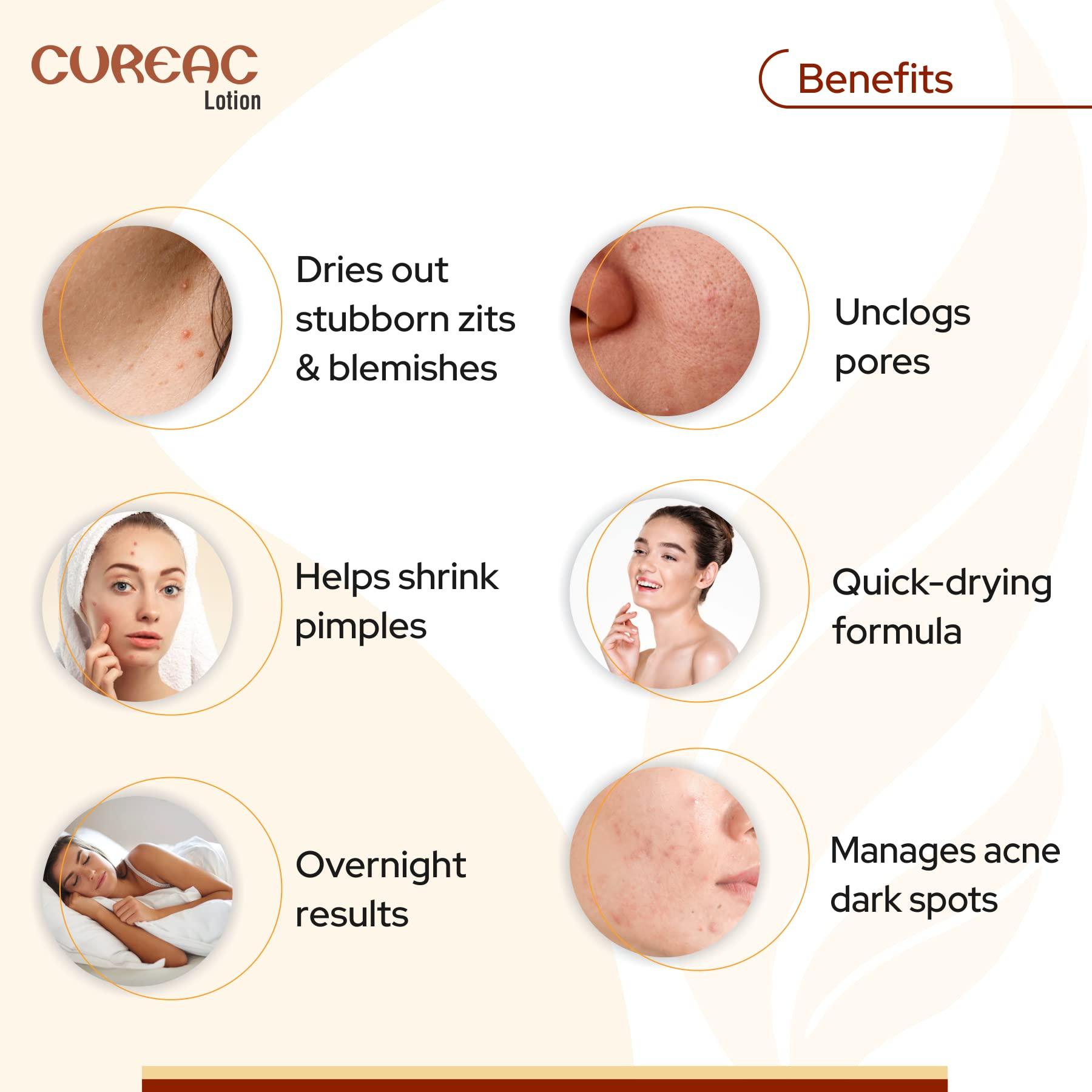 Salve Salve Acne Drying Lotion (70 ml (Pack of 2))