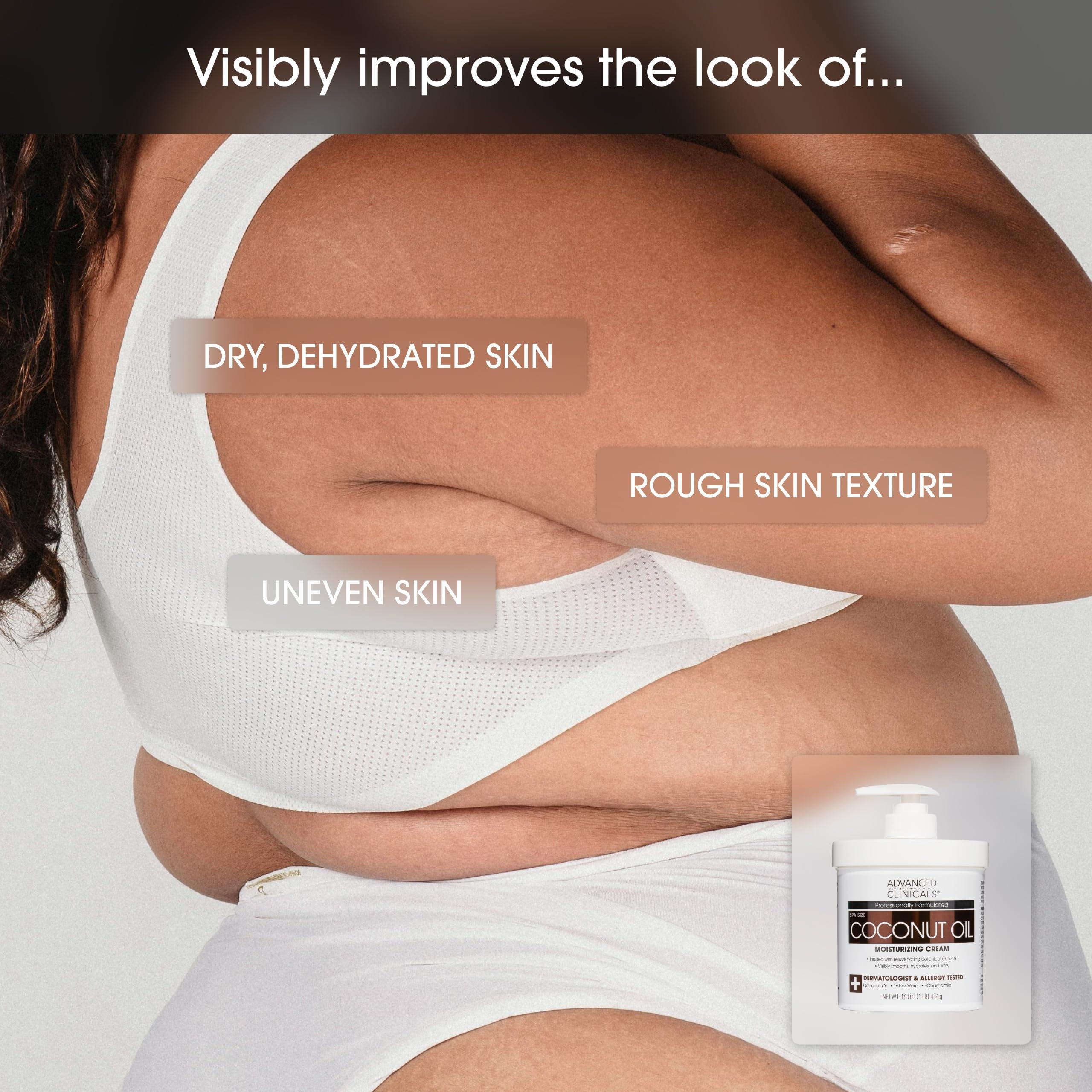 Advanced Clinicals Advanced Clinicals Retinol Body Lotion + Coconut Oil Cream 2pc Set | Moisturizer Face Lotion & Body Cream | Crepey Skin Care Treatment | Coconut Body Lotion + Retinol Cream Targets Crepe Skin, 2pc