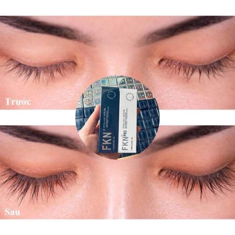 FKN FKN Rapid Growth Eyelash Serum - Day and Night Combo | Quick Result in 10 days to 4 Weeks - Perfect Christmas, Birthday, Special Holiday Gift | Creates Appearance of Longer & Darker Eyelashes|2 Packs