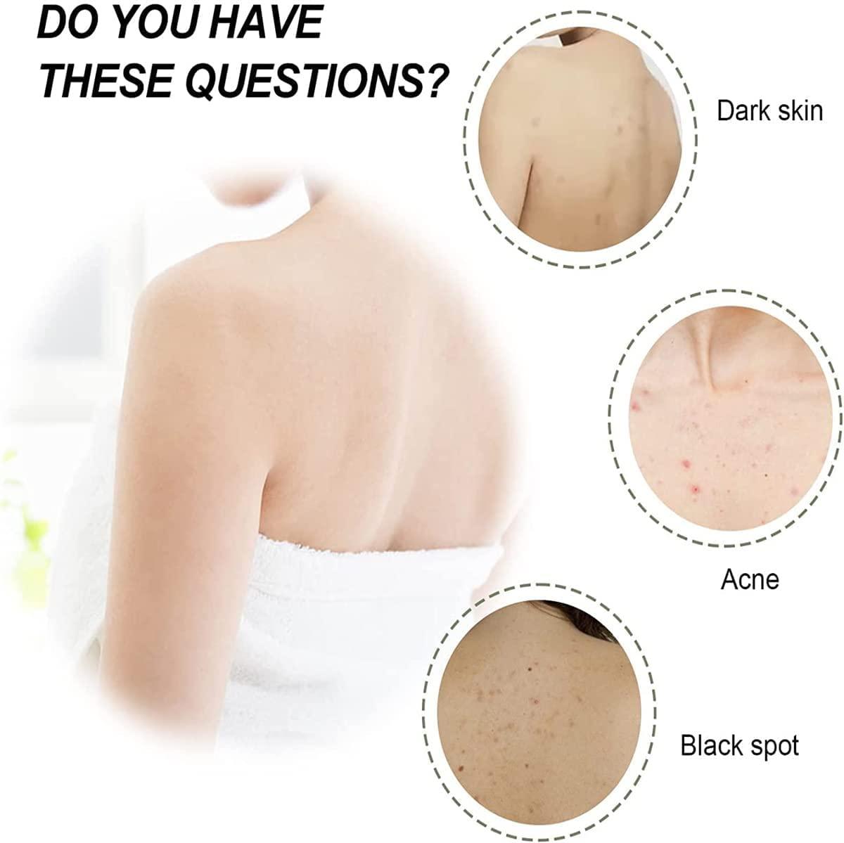 Hoddl Smooth Cream,Deeply Moisturize& smooth skin,for Rough and Bumpy Dry Skin (3Pcs)