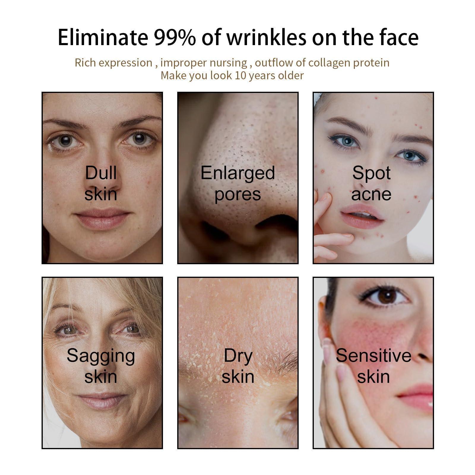 Blais Castor Oil Rosehip Oil Black Seed Oil, Castor Oil Black Seed Oil Rosehip Oil Face Serum, Natural Face Oil Anti-Aging Serum Natural Skincare, Nourishing, Firming Skin, Diminishing Wrinkles (5pcs)