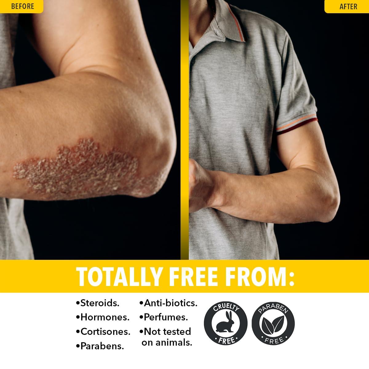 Dr. Robaina Dr. Robaina Sulfur Balsam Lotion Daily Moisturizing Lotion for Eczema and Psoriasis Relief Soothes Redness, Hydrates Sensitive Skin Natural Ingredients Made in the USA (Pack of 1)