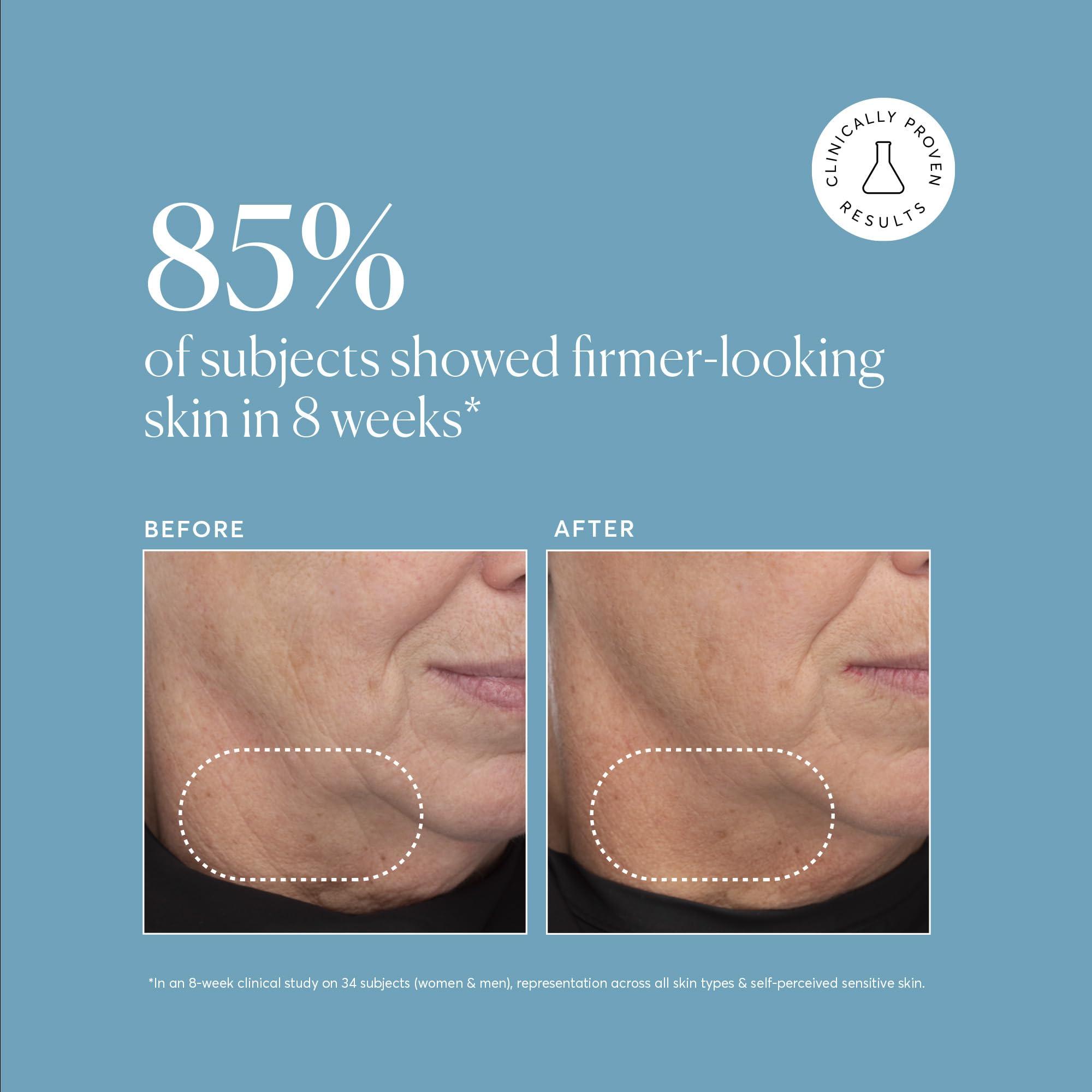 Naturium Naturium Retinol Complex Serum, Encapsulated Retinols & Bakuchiol, Refining & Smoothing Facial Serum, 1 oz