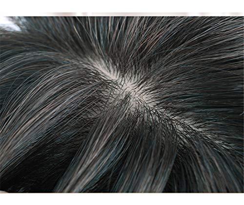 Susanki 100% Real Human Hair Crown Topper Hair Pieces for Women with Thinning Hair, Susanki 6" x 6.7" Silk Top Hair Toppers with Clip on, 10" Dark Brown