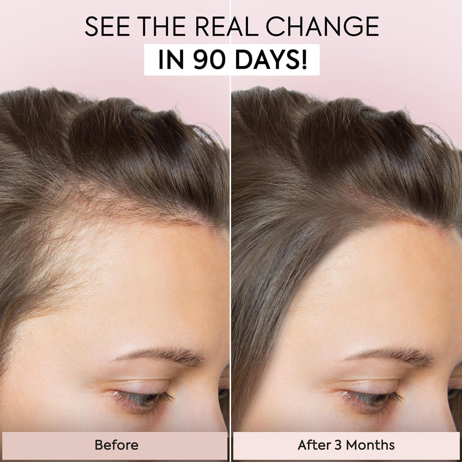 Jardient Jardient Hair Growth Serum: Veganic Natural Hair Growth Oil - Hair Loss Treatment for Women and Men - GRO Hair Serum for Thining Hair - Fuller Thicker and Healthier Hair in 90 Days, 2Pack X 1Fl Oz