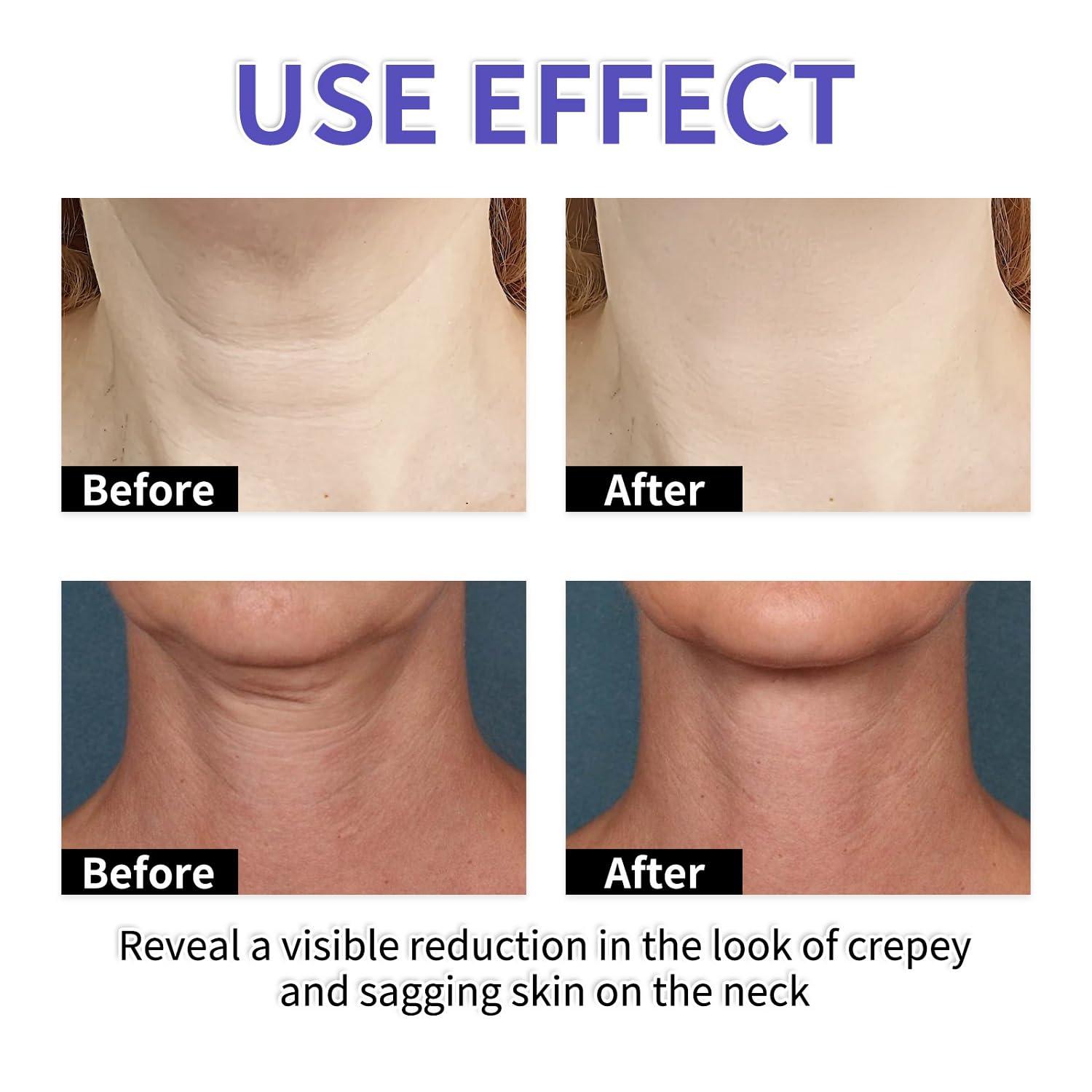 YG LianKai YG LianKai Neck Firming Cream, Tighten & Lift Neck Firming Cream, Anti-Aging Neck Creams for Tightening Lifting Sagging Skin and Hydrating, Help Reduce Fine Lines & Wrinkles