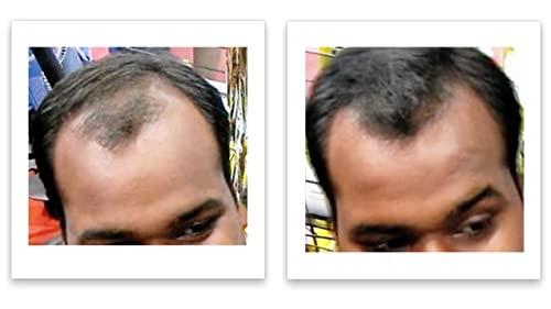 Caboki Caboki All-Natural, Plant-Based Hair Concealer Covers Bald Spot and Thinning Hair. (16G, 40-Day Supply). Black