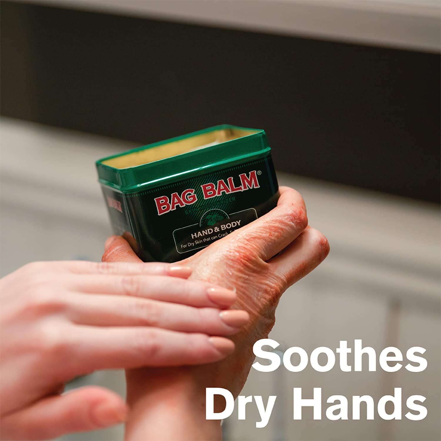 Bag Balm Bag Balm Vermont\'s Original for Dry Chapped Skin Conditions 8 Ounce Tin