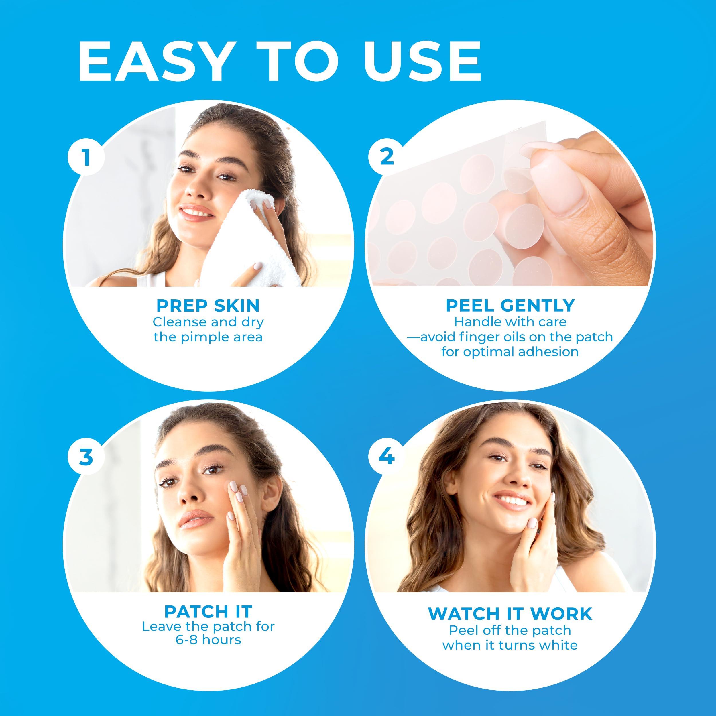 KEYCONCEPTS PatchRx Pimple Patches for Face (120 Patches), Hydrocolloid Acne Patches with Tea Tree Oil, Pimple Patch Pimple Stickers - Hydrocolloid Patch Acne Dots - Acne Pimple Patches For Face - Zit Patches