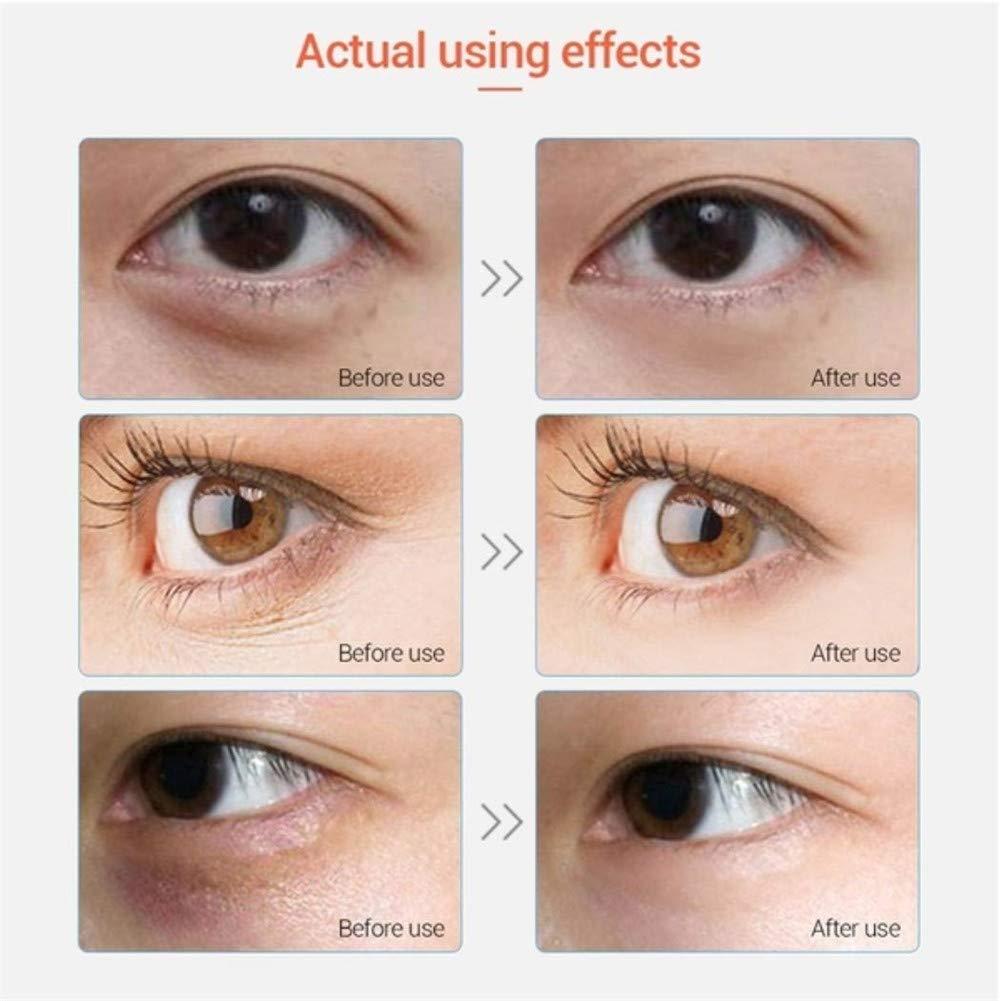 Adofect Adofect 30 Pairs Pink Eye Mask Collagen Eye Gel Pads Under Eye Patches Mask for Puffiness and Dark Circle Under Eye Patches for Women and Men