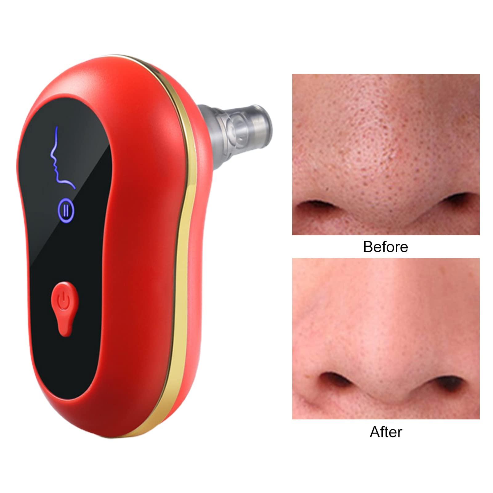 NEREIDS NET Blackhead Remover, Pore Cleaner, Pimple Cleaner,500mAh 3 Modes 5 Sucker Blackhead Remover USB Rechargeable Vacuum Face Pore Cleaner Tool Ivory