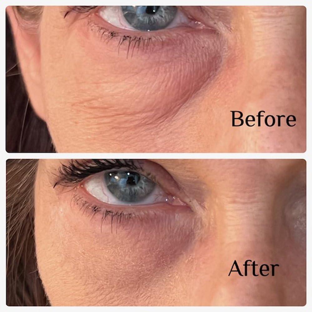 Generic Instant Eye Bag Puffiness And Wrinkle Remover Cream For Women And Men Made In The USA! Cruelty-Free