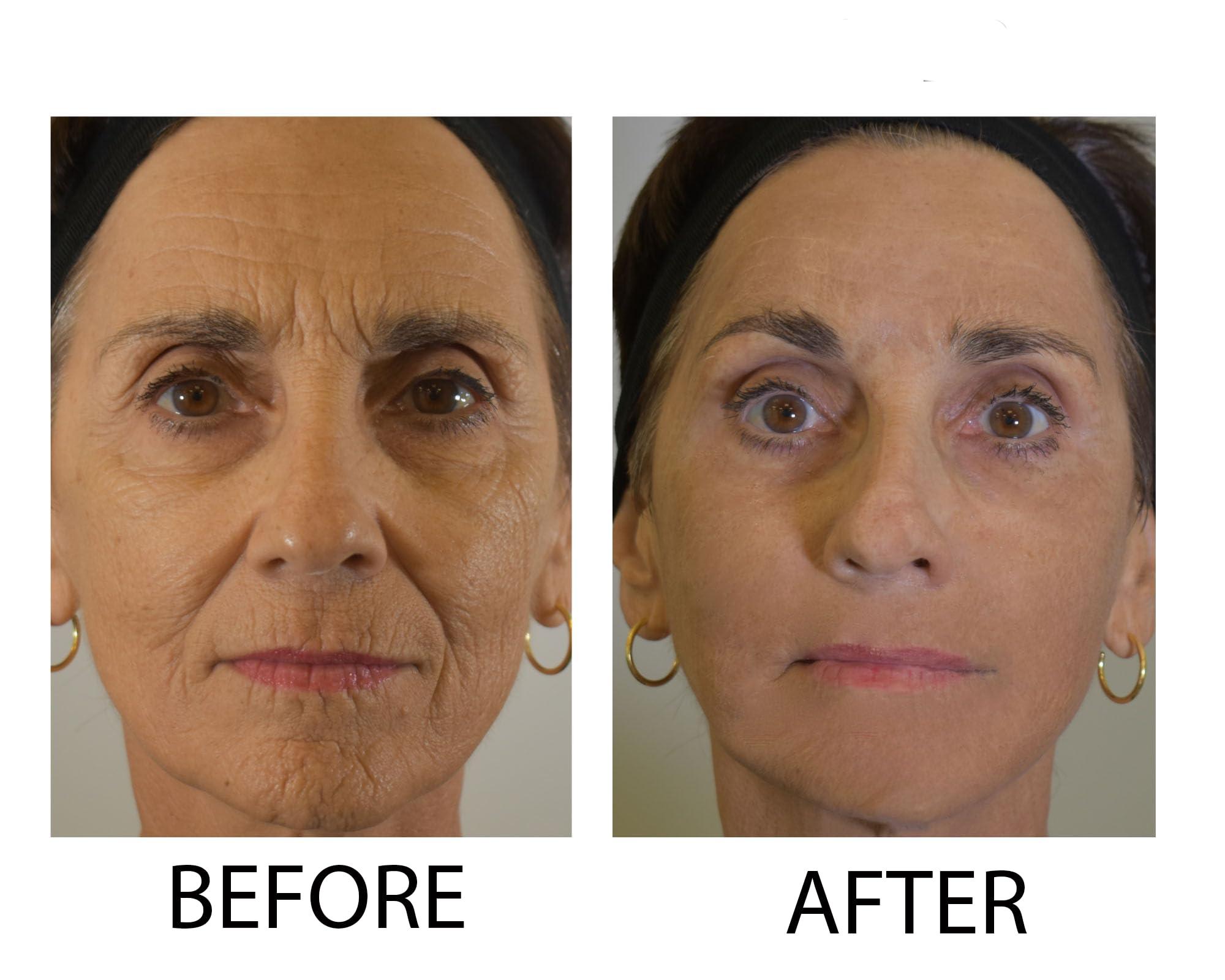 Dr.Sevinor Skincare Solutions Dr Sevinor Wrinkle Solution Wrinkle Smoothing Tinted Serum 1 FL OZ