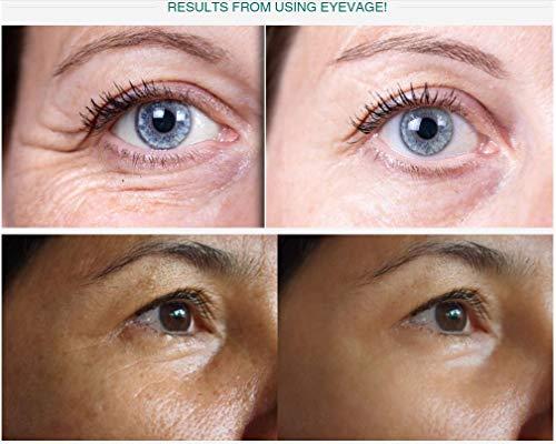 Solvaderm Solvaderm Eyevage Anti-Aging Eye Rejuvenation Treatment Cream For Puffy Eyes, Dark Circles, Fine Lines, Wrinkles & Crow’s Feet