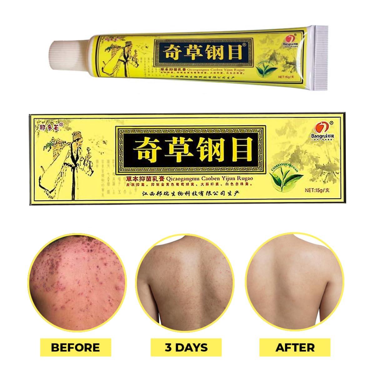 QICAOGANGMU QICAOGANGMU Official Seller - Chinese Herbal Cream - Natural Relief for Skin Issues - Pack of 3
