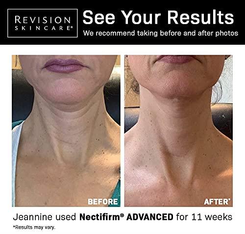 Dr. Bronner's Dr. Bronner\'s - Organic Sugar Soap (Peppermint, 24 Ounce) - Made with Organic Oils, Sugar & Shikakai Powder, 4-in-1 Uses: Hands, Body, Face & Hair, Cleanses, Moisturizes & Nourishes, Vegan