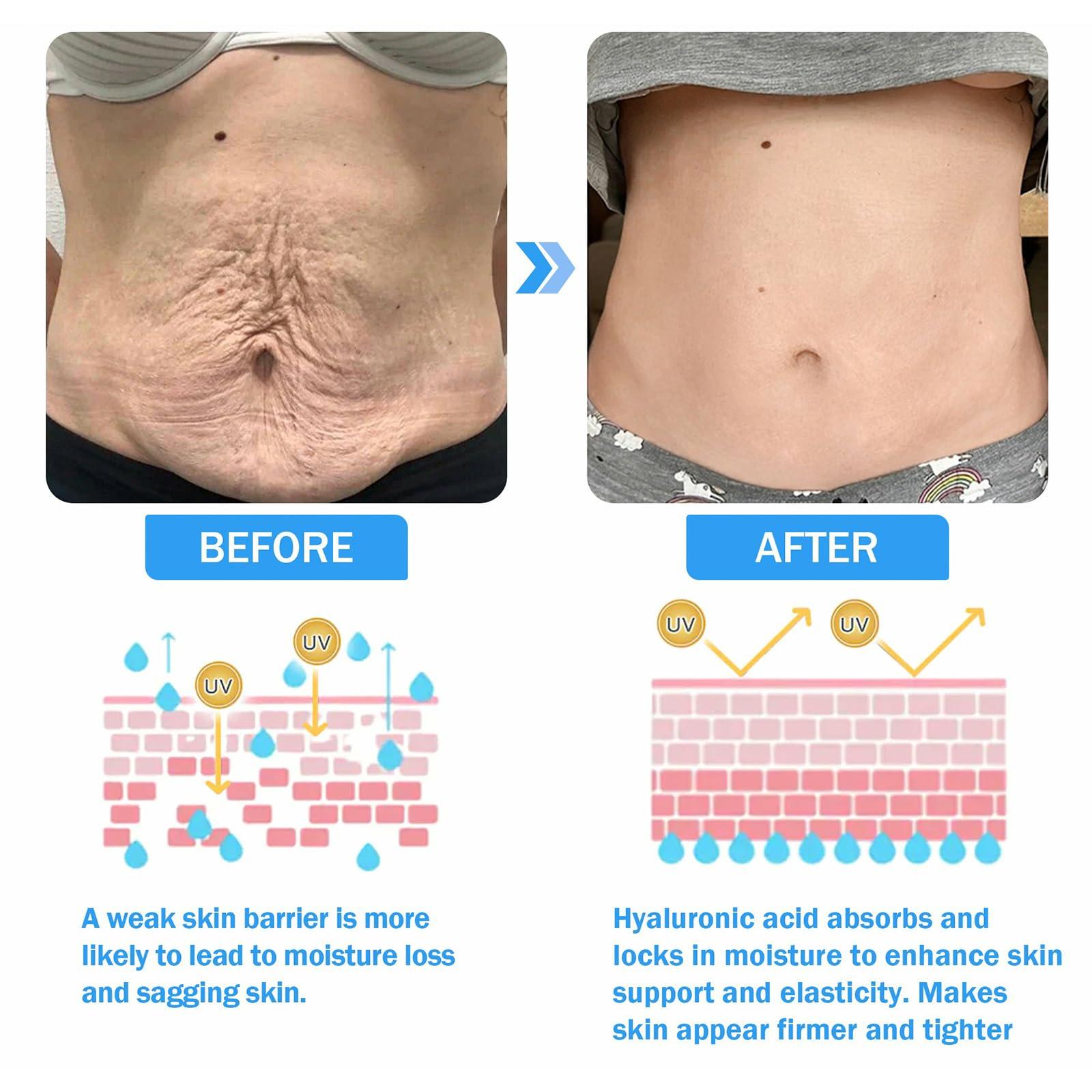 AEEHFENG Aeehfeng Firm Tighten Skin Tighten Cream,Advanced Anti Wrinkle Moisturizer Face&Body Cream,Crepey Skin Care Treatment Targets Look of Crepe Skin, Wrinkles, Sagging for All Skin Types (4Bottles, 100ml)