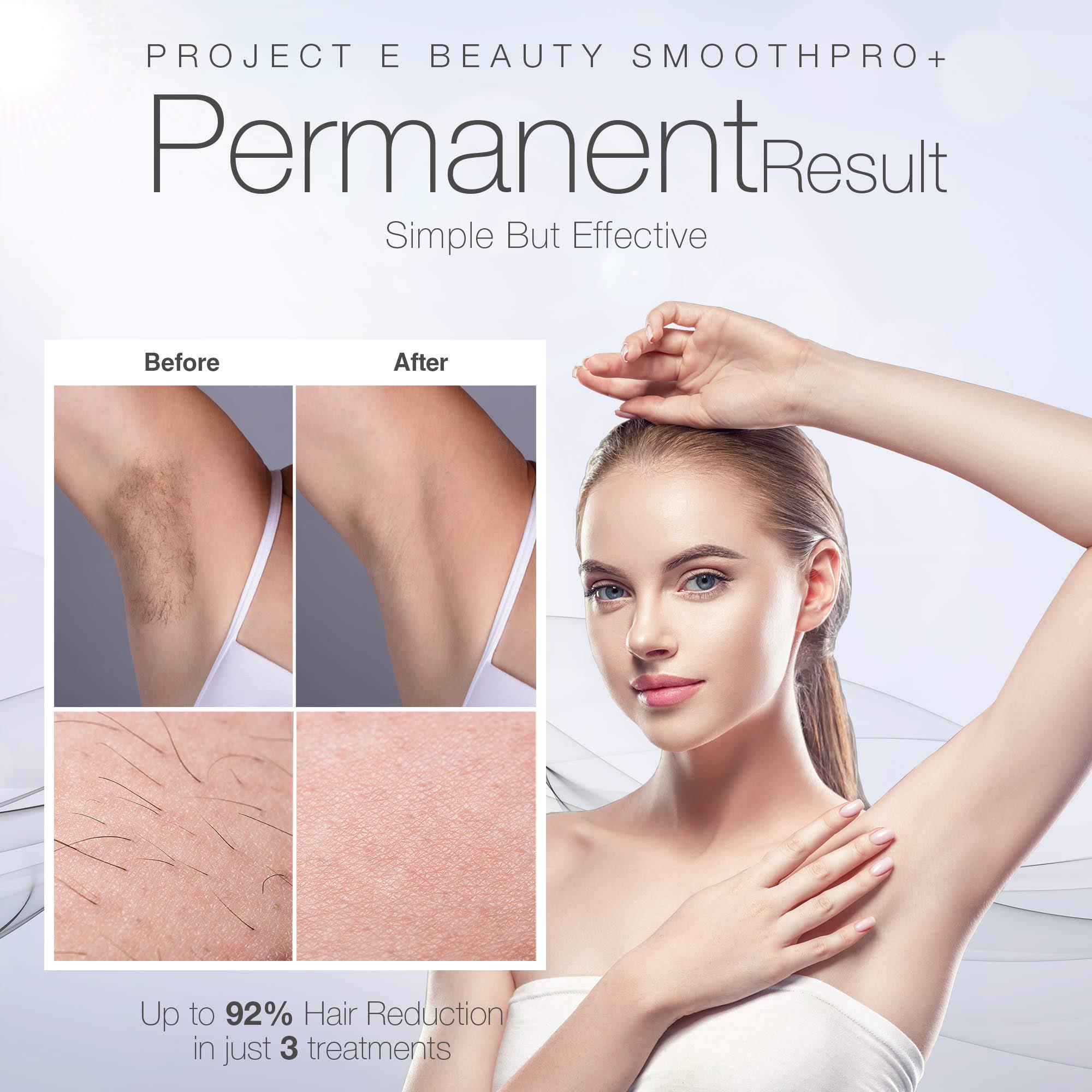 Project E Beauty SmoothPro+ IPL Hair Removal Device by Project E Beauty | Intense Pulsed Light | FDA Cleared | Permanent Hair Reduction | 300,000 Flashes Permanent | Painless | 5 Energy Levels | Stop Hair Regrowth