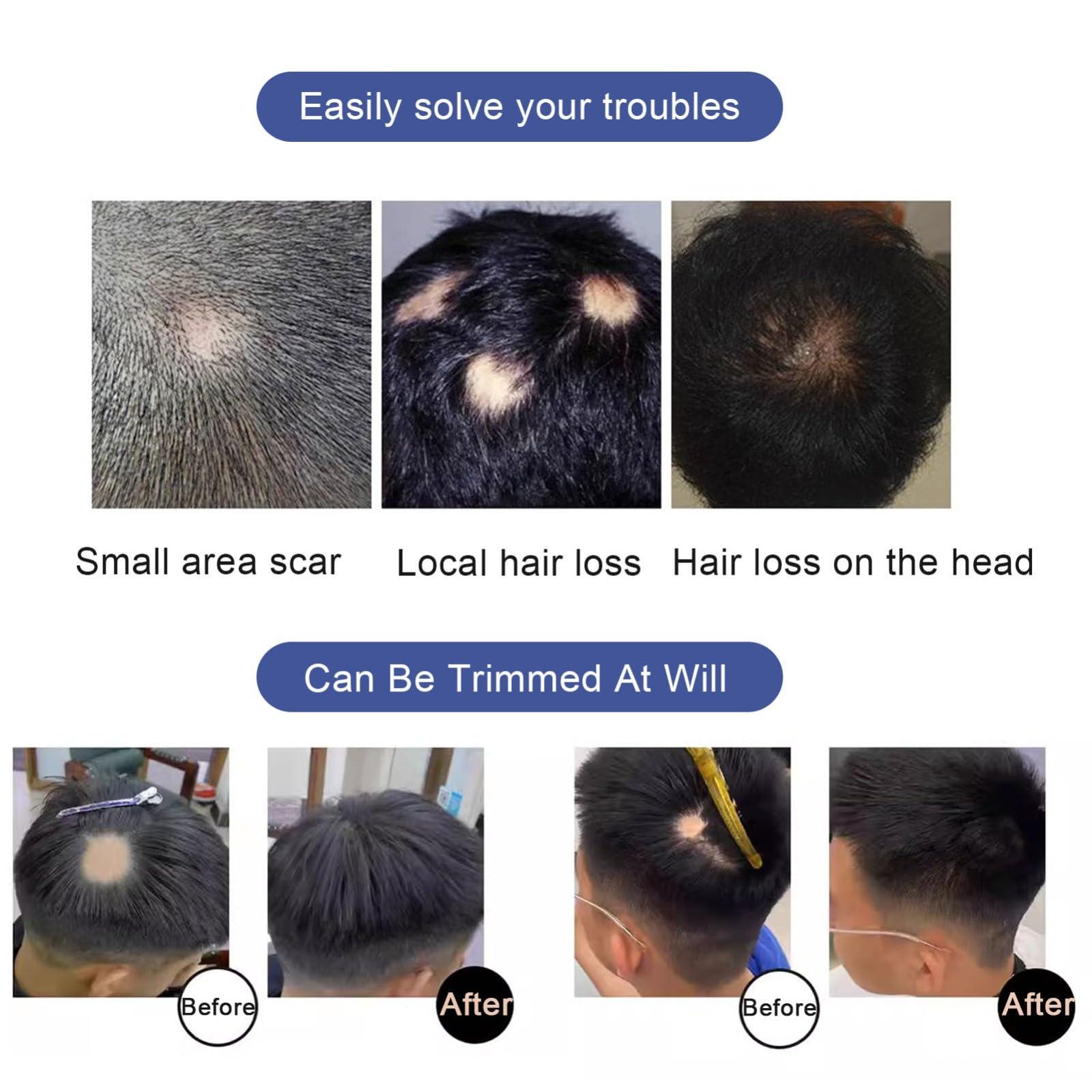 ZBYXPP ZBYXPP Bald Spot Hair Patch Toupee, Human Hair Natural Hair Replacement Unit For Men and women Hairline(Black,2cm)