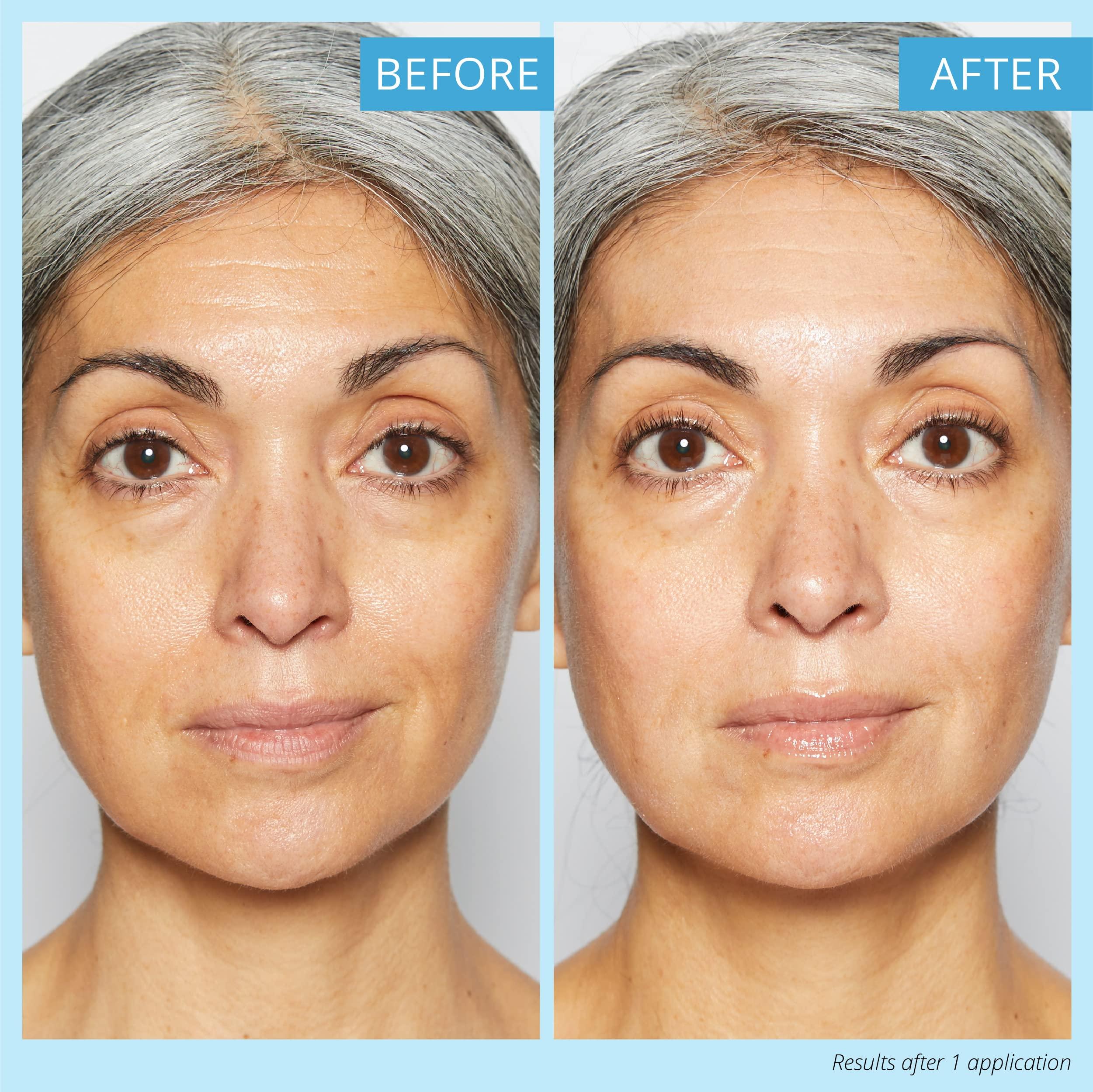 SKINN SKINN DermAppeal Microdermabrasion Treatment for Smoother, Brighter, and Clearer Skin, 1oz - Exfoliating Facial Scrub Removes Dead Skin and Smooths Wrinkles and Fine Lines for Flawless, Glowing Skin