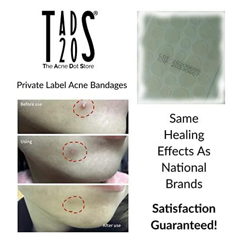 The Acne Dot Store 3pk, [120] Acne Dot Pimple Patches [SMALL SIZE] Cystic Acne Patch, FACE Spot Dots, Zit Sticker, Hydrocolloid Bandages, Blemish Spot Treatment, tads20
