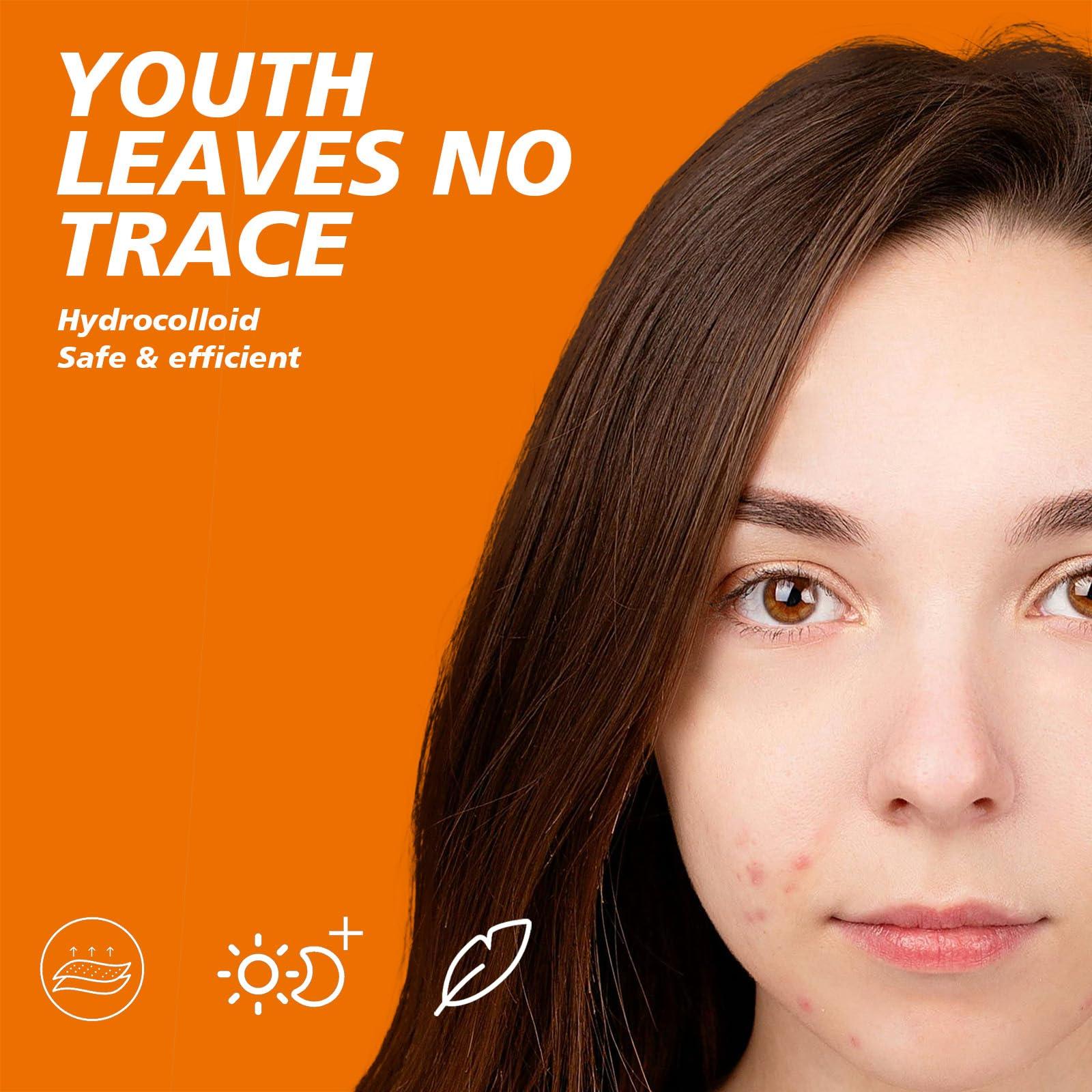 Leoezx Leoezx Acne Pimple Patches 72 Pcs,Acne Spot Dots,Facial Acne Patch,Hydrocolloid Acne Patch for Face,All Skin TypesAcne Patch & Pimple Patch