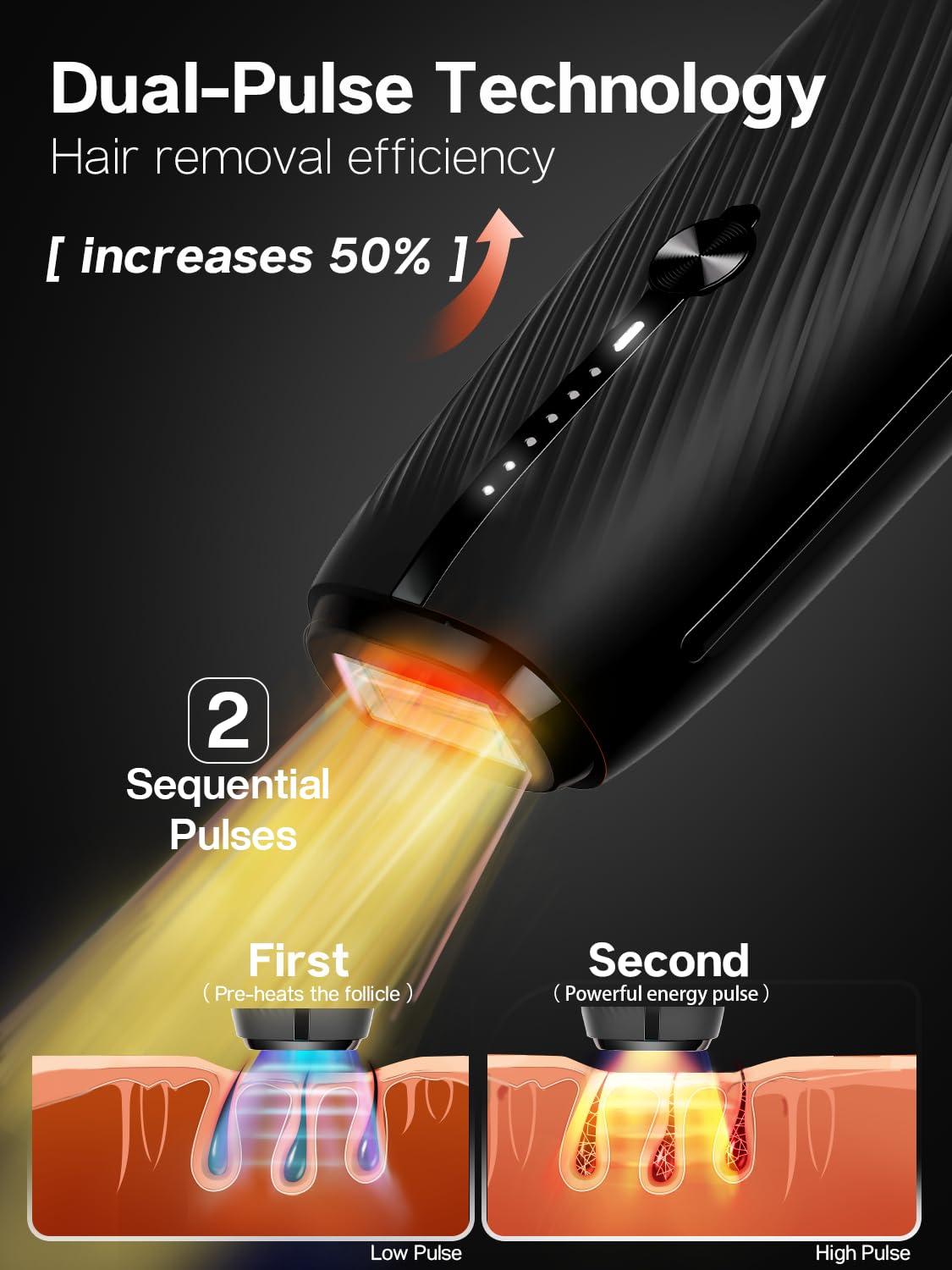 Blex Blex Laser Hair Removal for Women and Men, IPL Hair Removal Device Effective in 2 Weeks, with Ultra-Fast 0.2s Light Emission, Comfortable and Painless