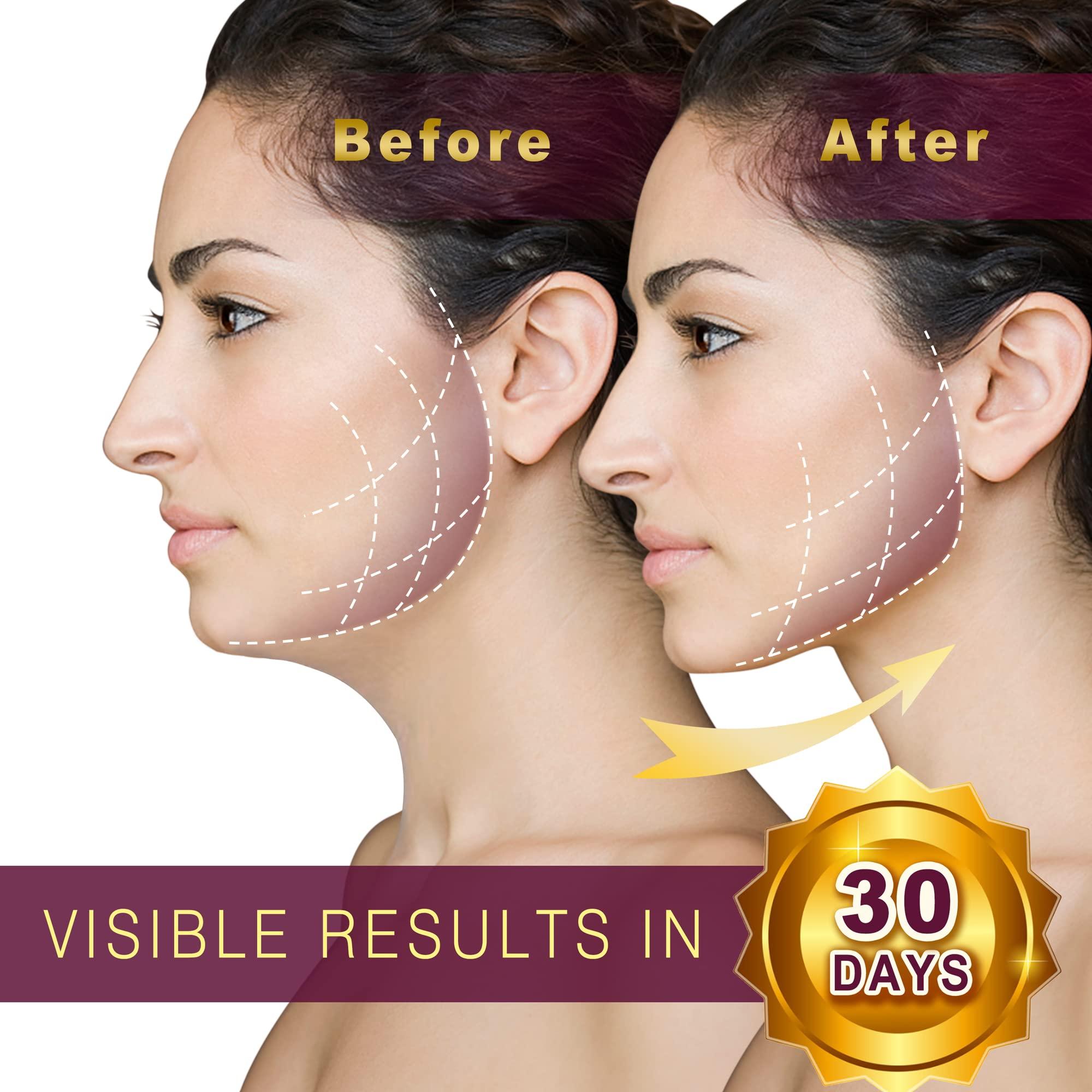 EDCBMB Double Chin Reducer,Face Slimming Strap,V line Lifting Mask,Eliminator, Remover,Tape,V Shaped Belt Facial for Women and Men,Reusable Strap for sleeping jawline Jaw Exerciser EDCBMB