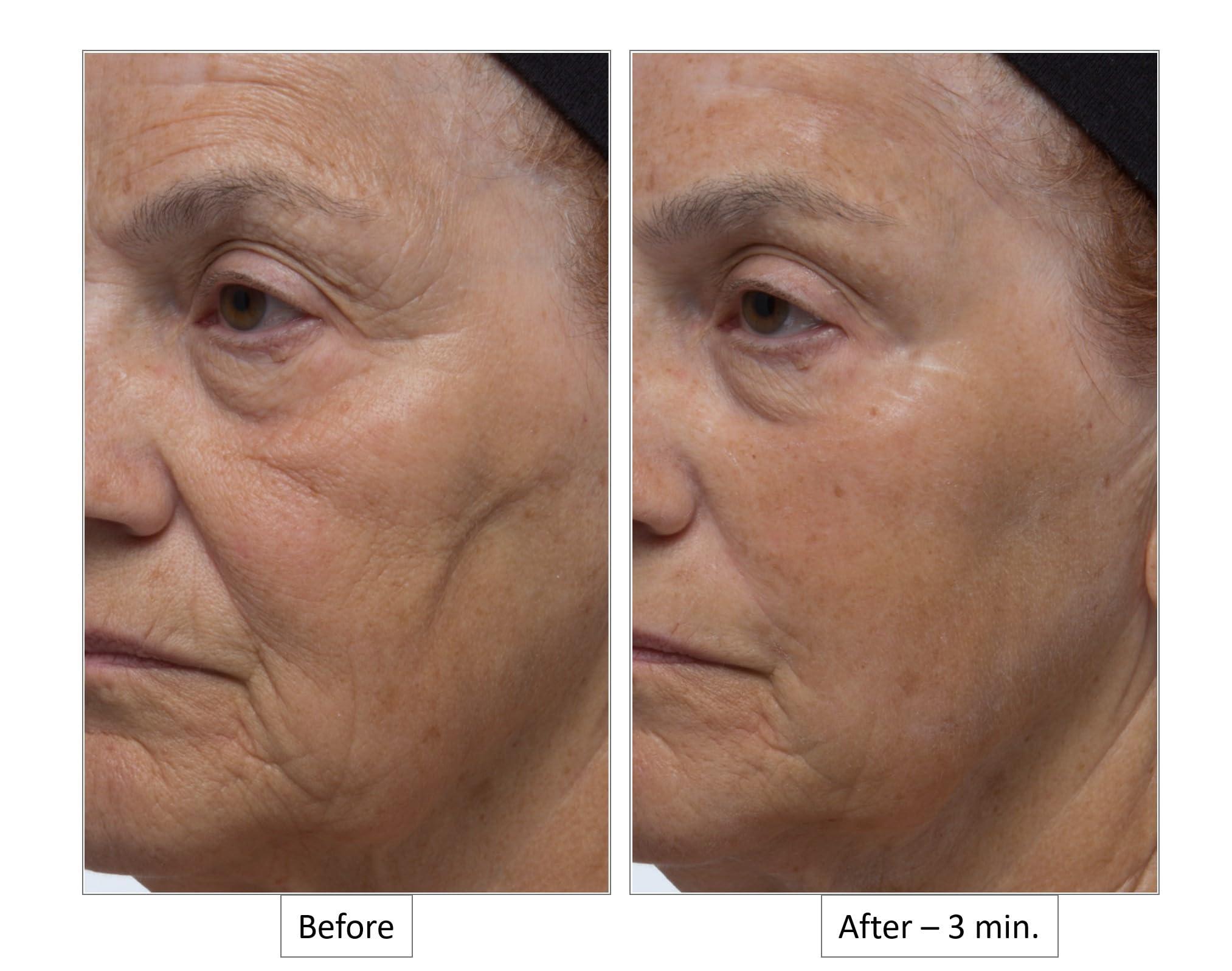 Dr. Denese Dr. Denese Wrinkle Lost Line Reducer, 3 Minute Age Eraser With Silk Protein Fiber Technology