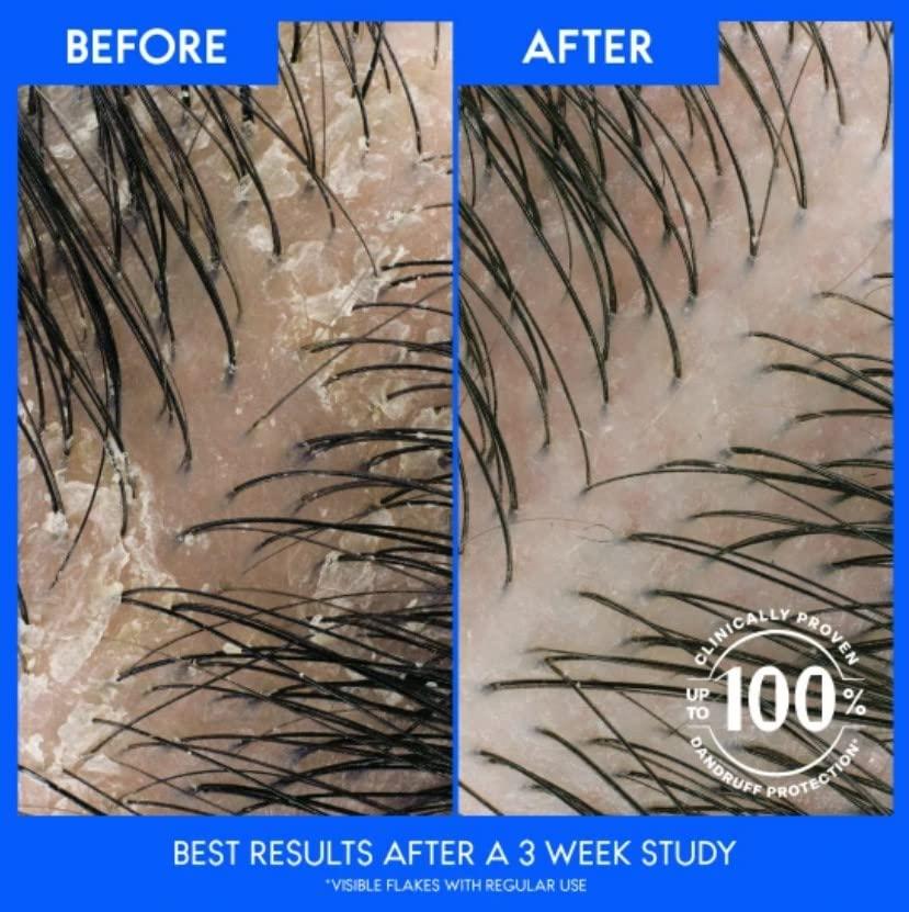 Head & Shoulders Head & Shoulders Men Old Spice Pure Sport Anti-Dandruff Shampoo, Paraben Free 12.5 Fl Oz (Pack of 2)