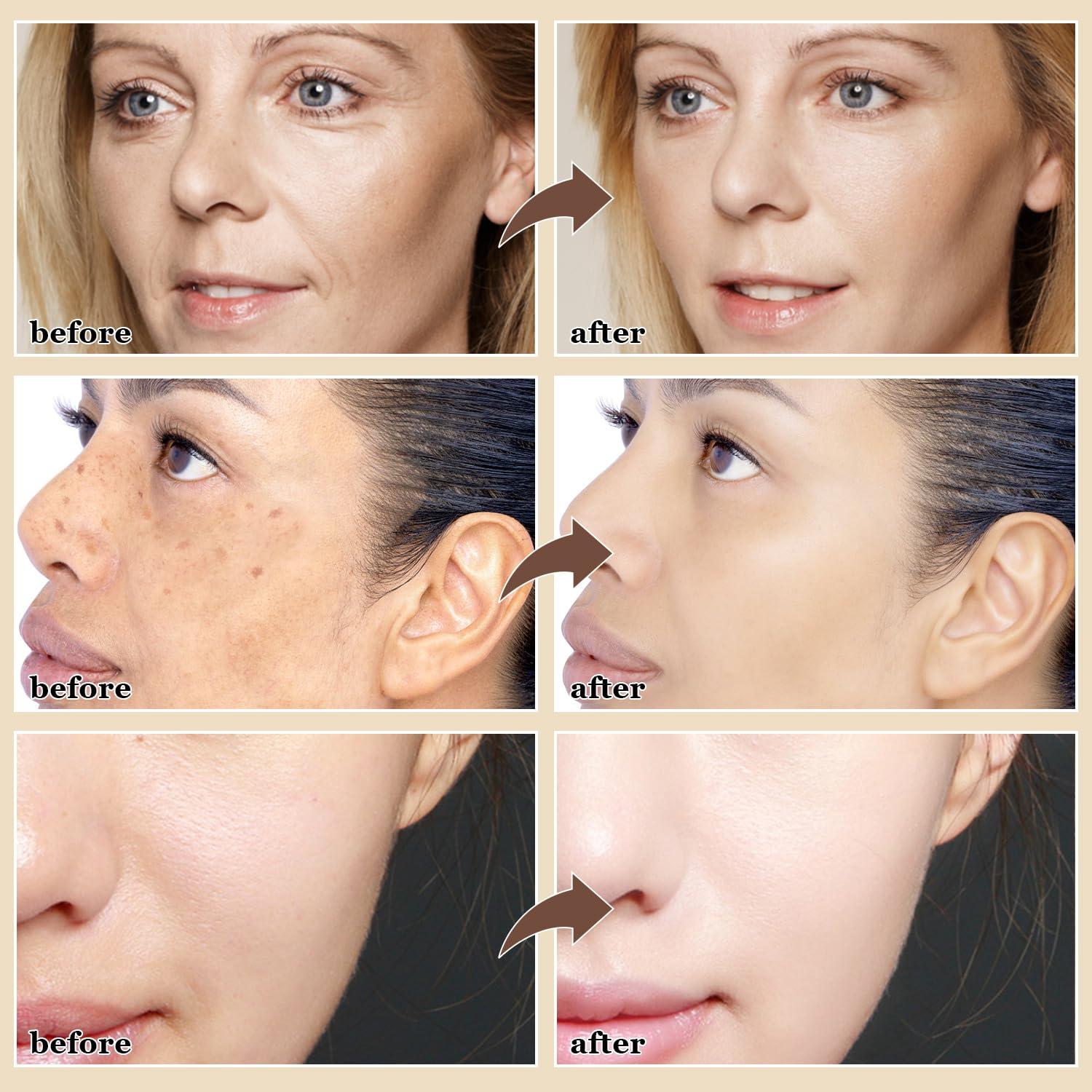 Baysea Removing Essence, 30ml Magic Vitamin C Serum for Face, Anti Spot Face Serum, Vitamin C Face Cream for Women (2 Bottles)