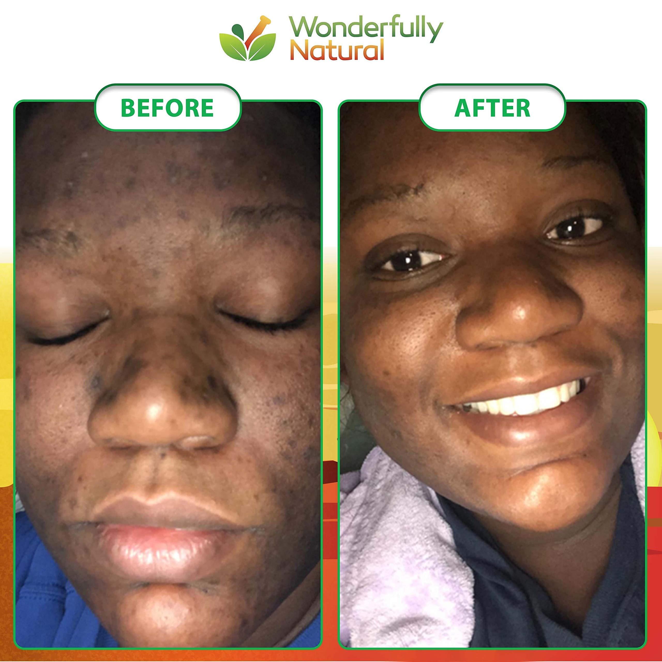 Wonderfully Natural Organic African Black Soap - For Acne & Dark Spots | Natural Vegan and Cruelty Free Satisfaction Guarantee 1lb bar | 90 day Supply