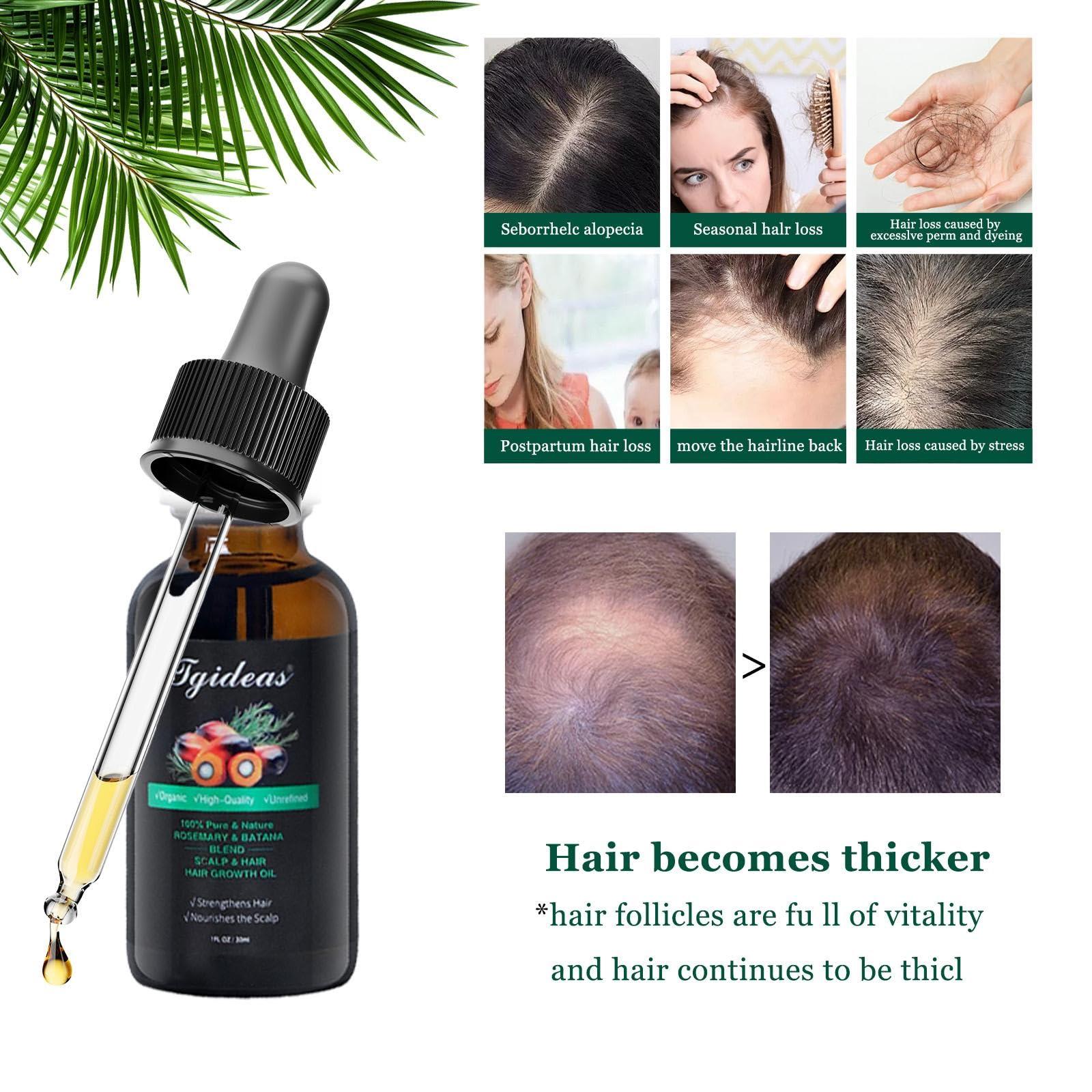 Tgideas Tgideas Organic Rosemary Oil For Hair Growth Infused With Batana- Hair Strengthening Treatment Oil for All Hair Types-Prevents Hair Loss, Enhances Hair Thickness in Men& Women