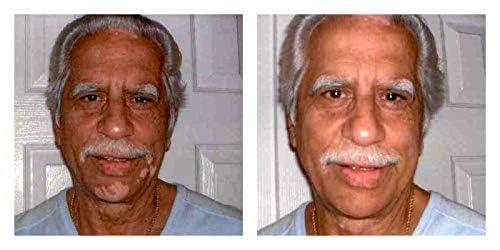 Judith August Judith August Killer Cover - Light/Medium - Cover Bruises, Tattoos, Age Spots, Vitiligo & More