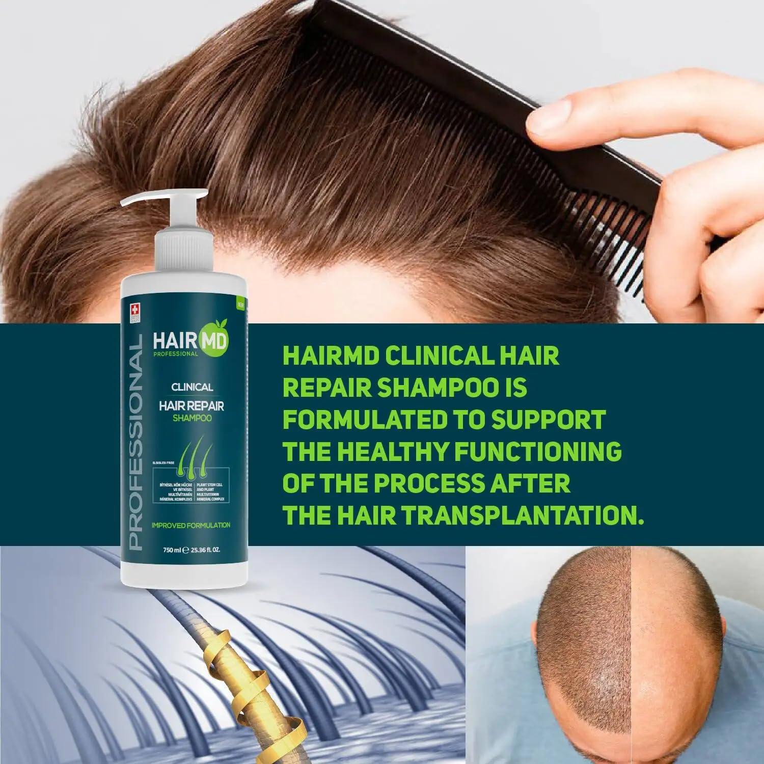 HairMD HairMD Transplant Clinical Repair Shampoo - Big Size 750ml - Advanced Regrowth Formula - Protects Post-Transplant Scalp, Exclusive Anti Hair Loss Shampoo. 25.36 fl OZ.