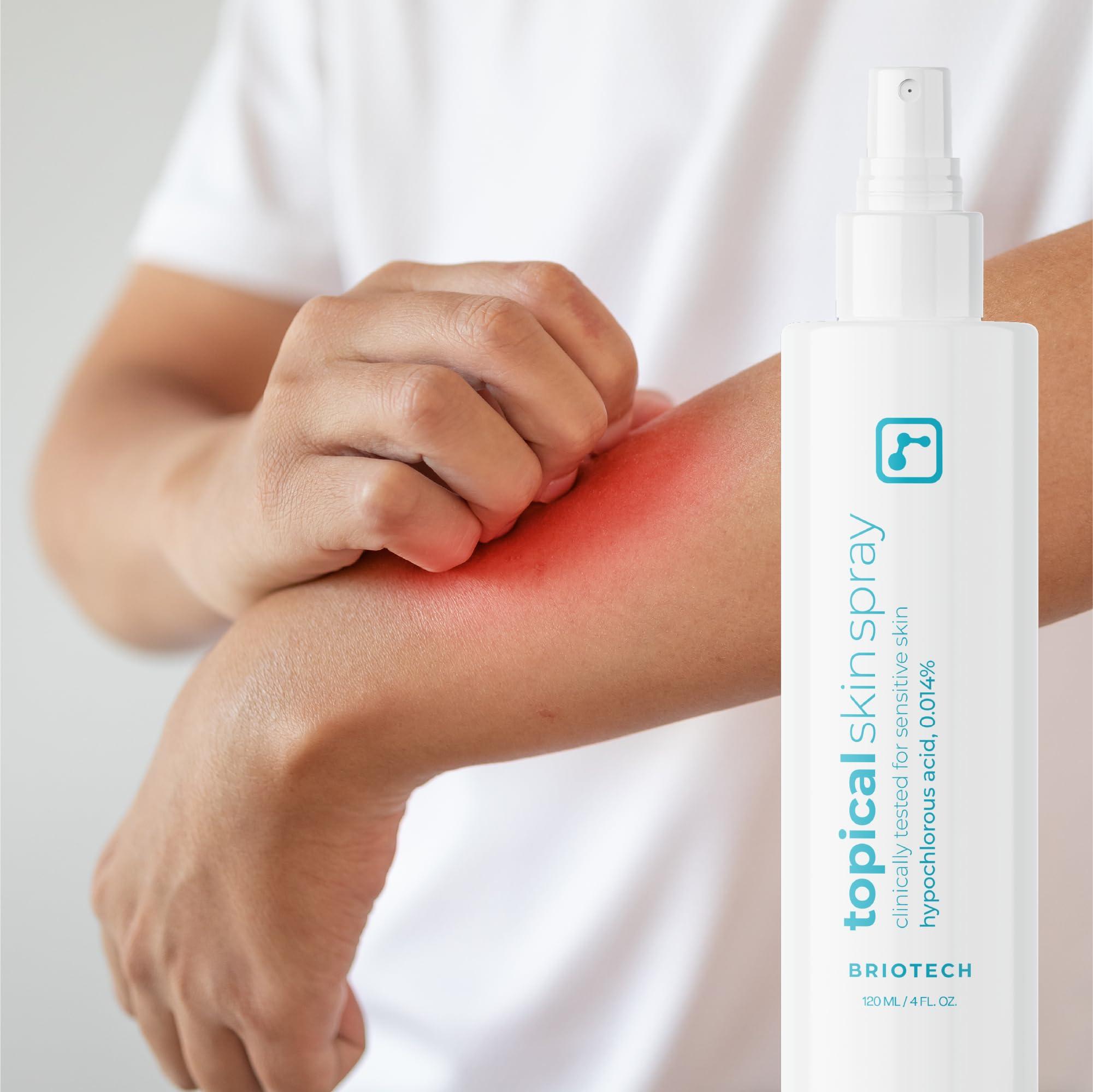 BRIOTECH BRIOTECH Topical Skin Spray, Hypochlorous Acid Spray for Body & Face, Eyelid Cleanser, HOCl Facial Mist, Support Against Irritation, Calm Redness, Soothe Scalp, Packaging May Vary, 4 oz ea, 2 ct