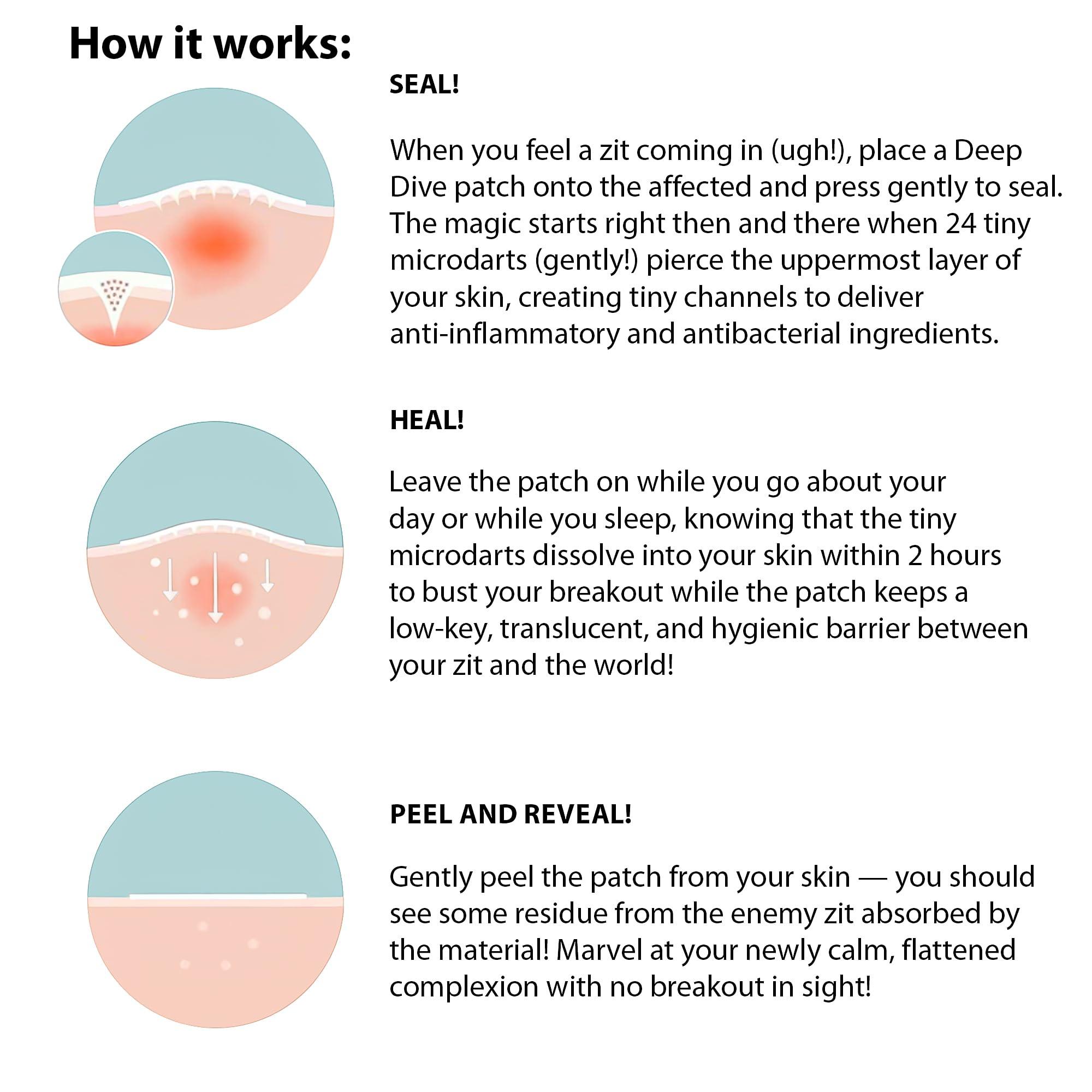 Frilliance Frilliance Microdart Hydrocolloid Acne Pimple Patches for Zits and Blemishes (4 count) Spot Treatment Stickers for Face & Skin, Vegan and Cruelty Free (Deep Dive Micro Darts)