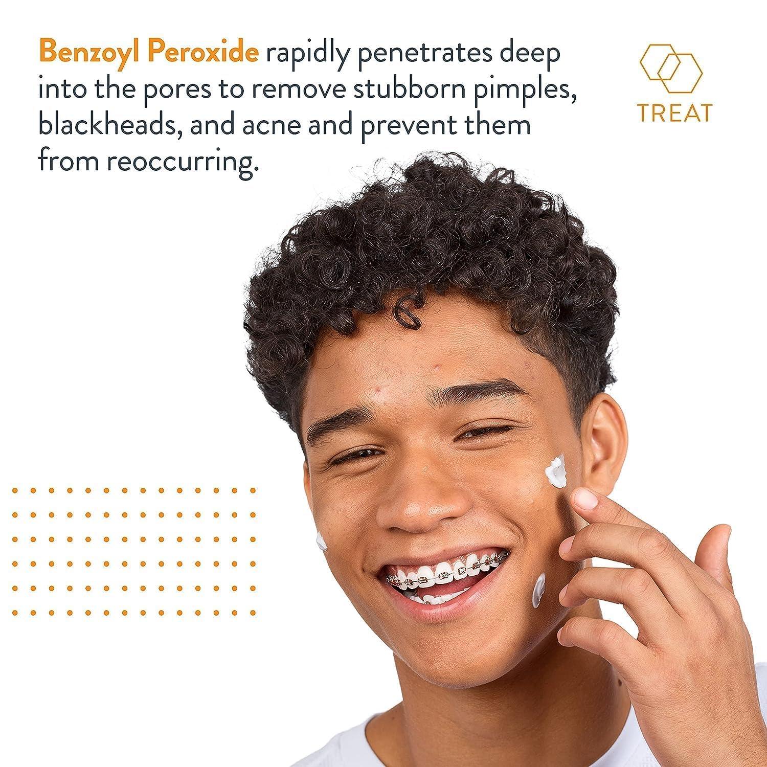 AcneFree AcneFree Terminator 10 Acne Spot Treatment with Benzoyl Peroxide 10% Maximum Strength Acne Cream Treatment, 1 Ounce - Pack Of 1