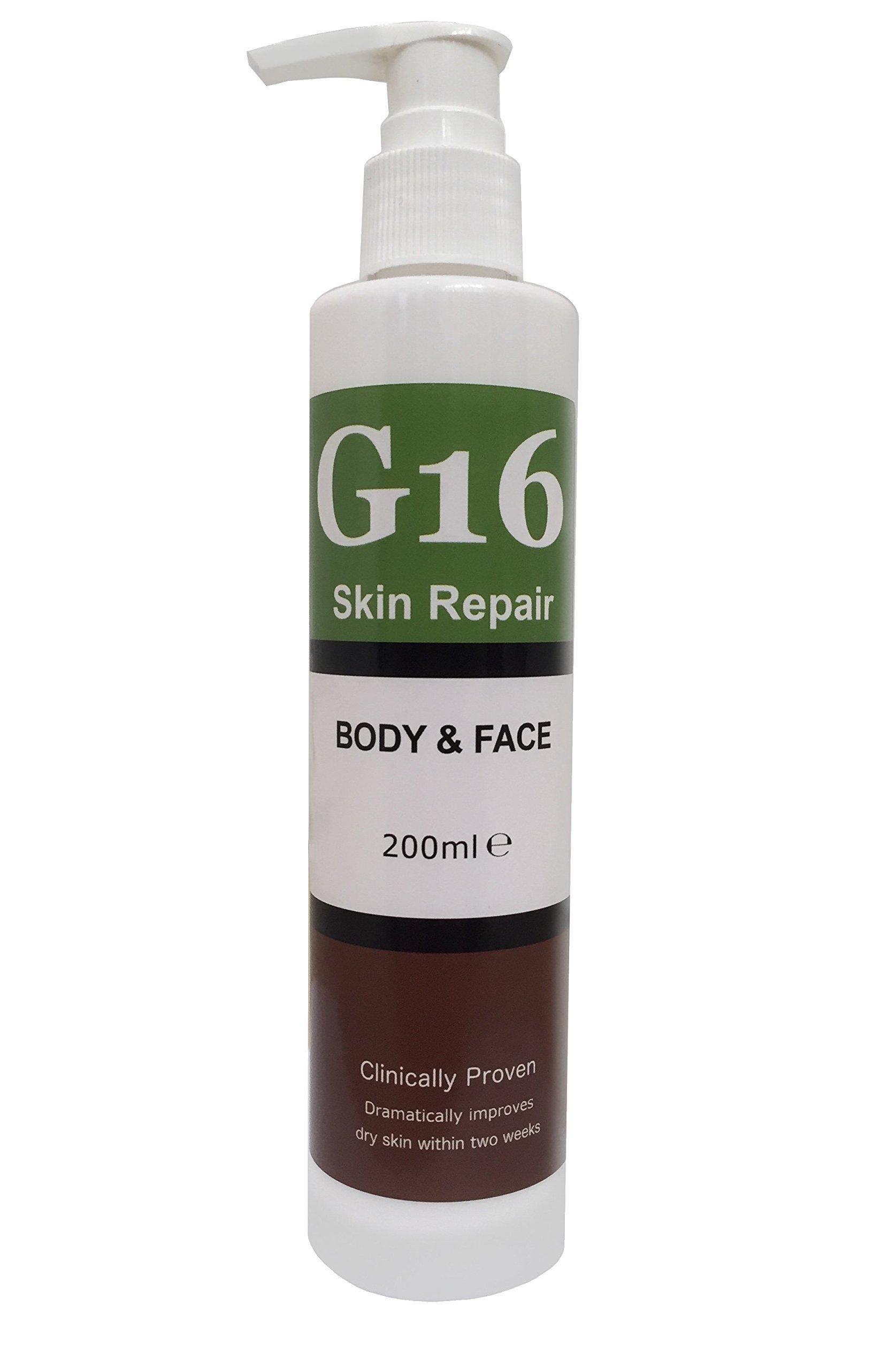 G16 Lotion G16 Skin Repair, Very Dry Skin & Ichthyosis Treatment Cream & Lotion