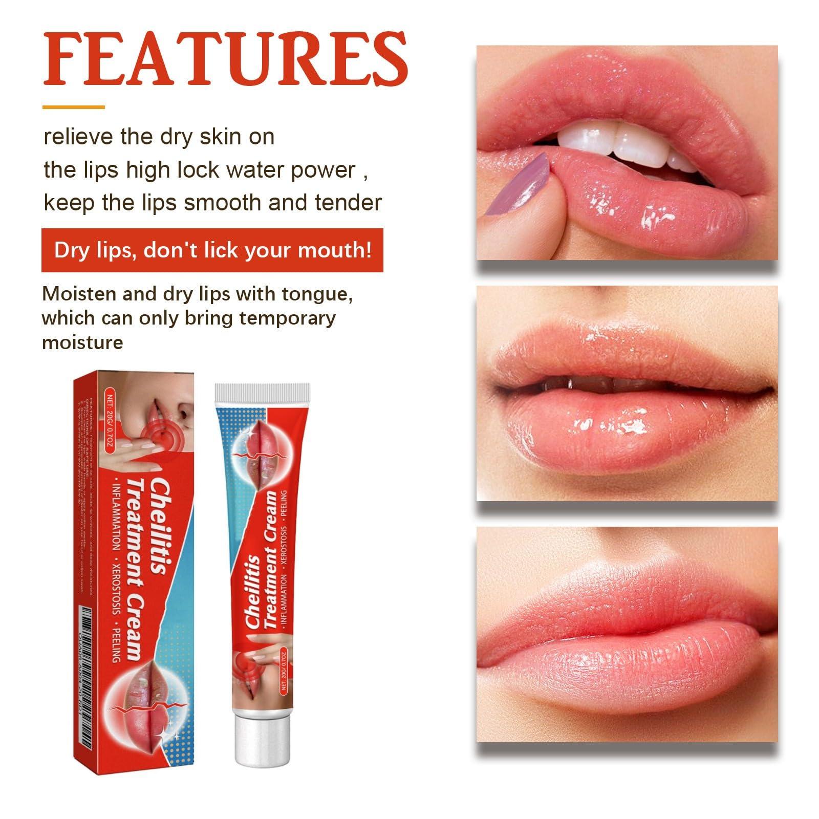 BEROZA Lip Balm, Lip Lightening For Dark Lips, 20g Lip Balm Moisturizing, Lightening balm for Men and Women Moisturizer Essence, Moisturizing Brighten Lip Care Mask (1pcs)