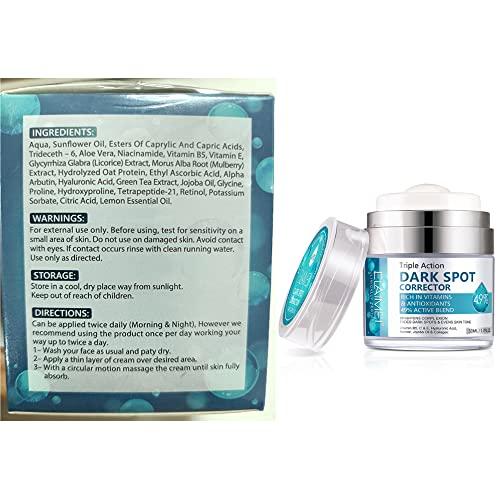 SWETIYOU Dark Spot Remover for Face, Fast-Acting Dark Spot Corrector Remover for Face and body Hyperpigmentation, Fades Melasma, Freckle, Sun Spots, Evens Skin Tone, Age Spot Remover for Women Men