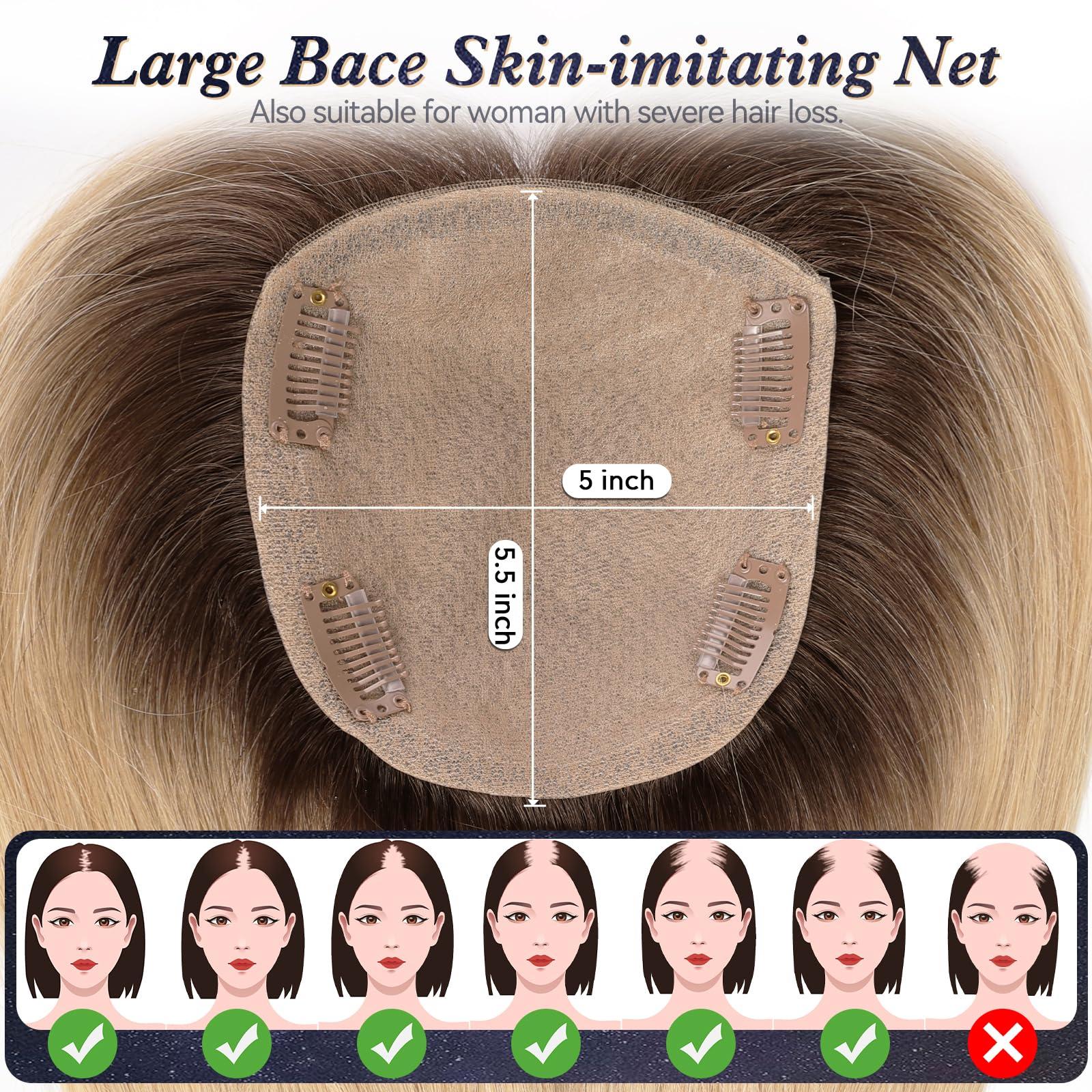 starluck starluck Hair Toppers for Women with Bangs, 5\"*5.5\"Large Coverage Ombre Light Blonde 100% Real Human Hair Toppers for Women with Thinning Hair,Cover Gray Hair Roots