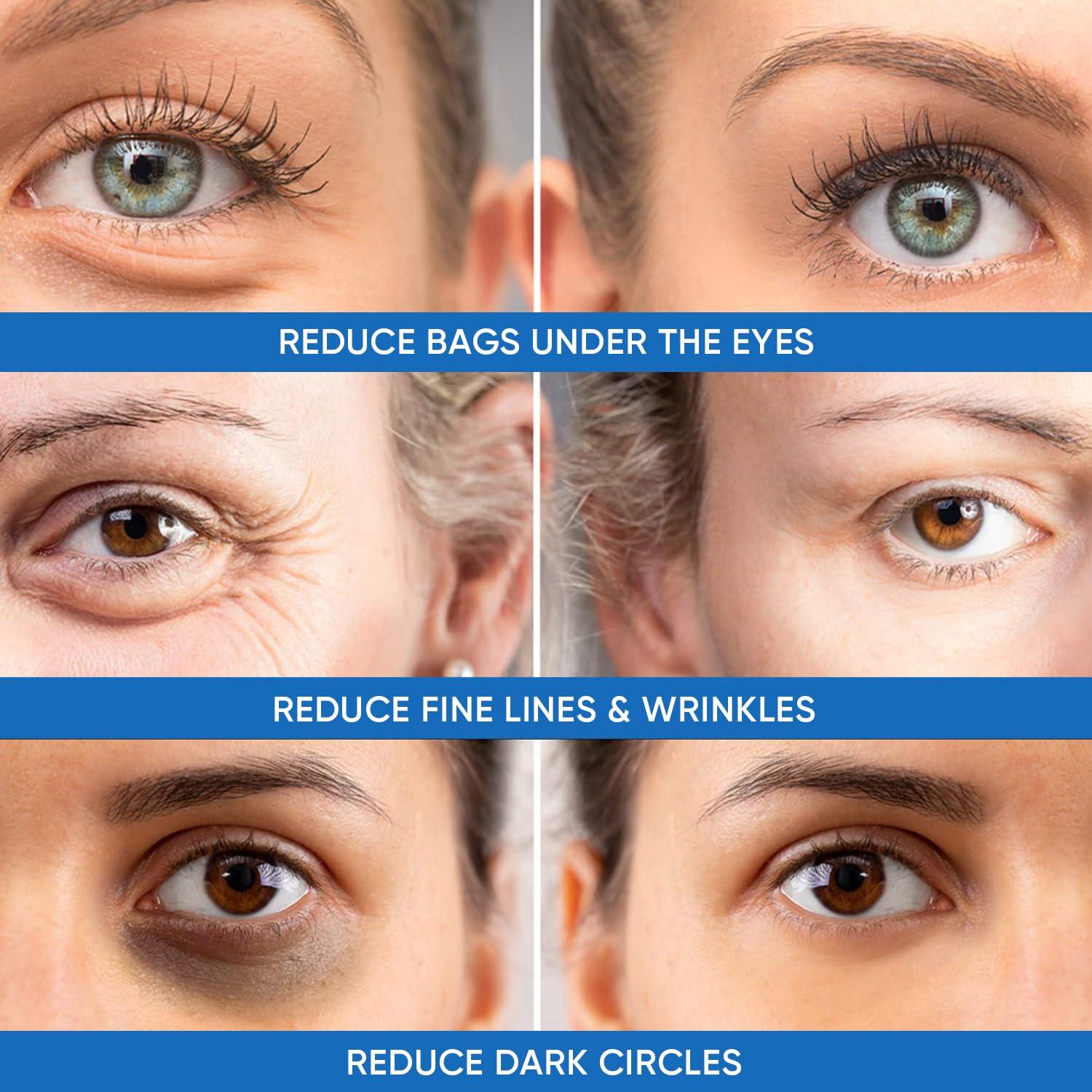 Dermlogic Under Eye Puffiness & Dark Circles Rapid Treatment- Instantly Reduces the Appearance of Puffy Eye Bags, Crows Feet, & Sagging Skin.